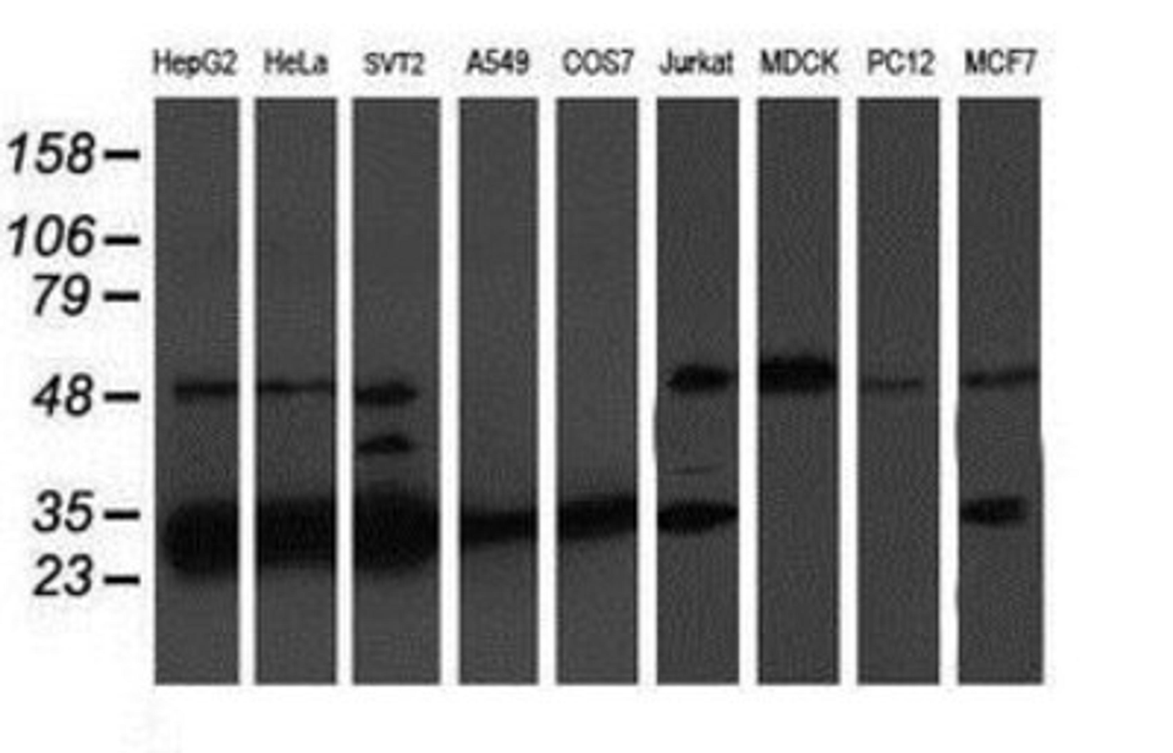 Western Blot: Proteasome 20S beta 7 Antibody (1E1) [NBP2-01832] Analysis of extracts (35ug) from 9 different cell lines by using anti-Proteasome 20S beta 7 monoclonal antibody.