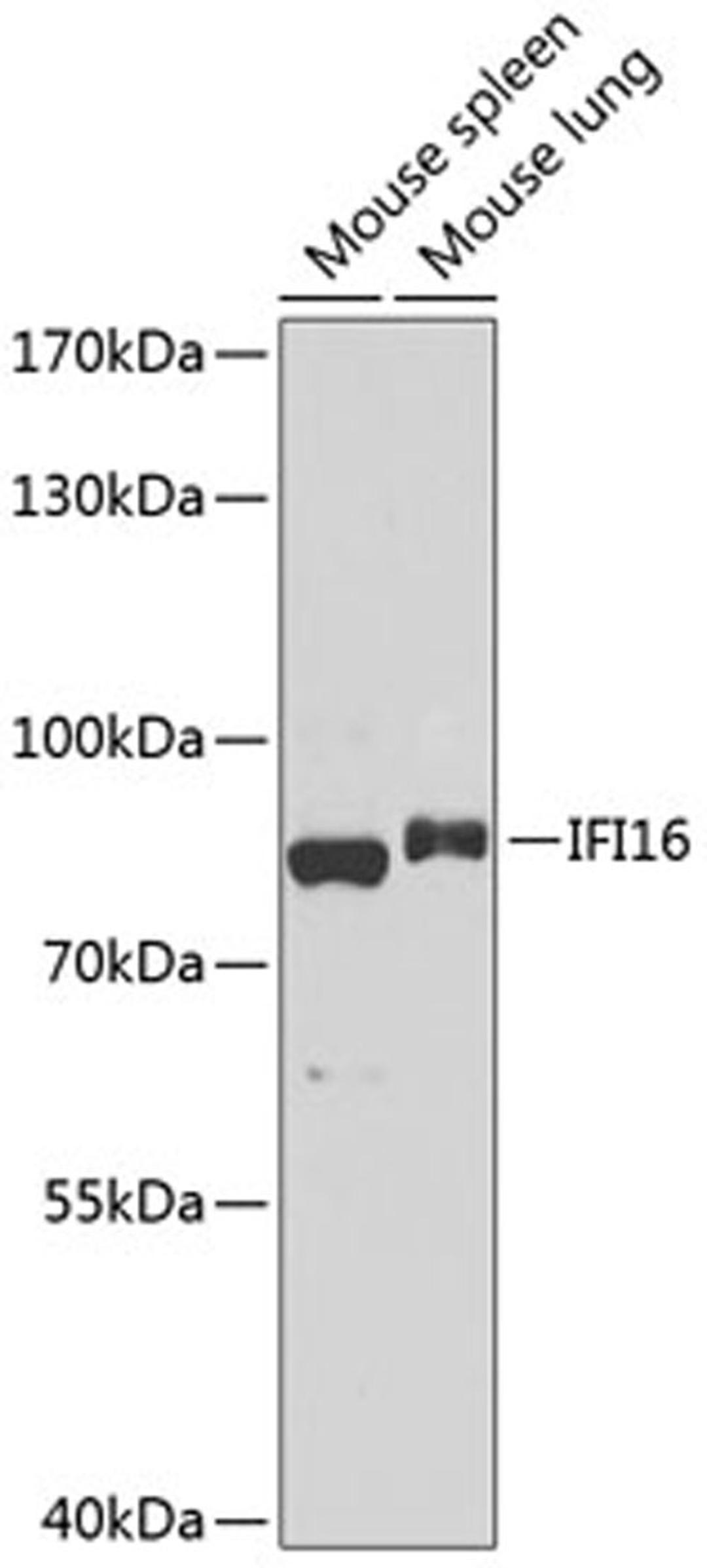 Western blot - IFI16 antibody (A14002)