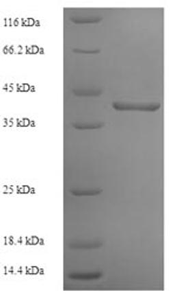 (Tris-Glycine gel) Discontinuous SDS-PAGE (reduced) with 5% enrichment gel and 15% separation gel.