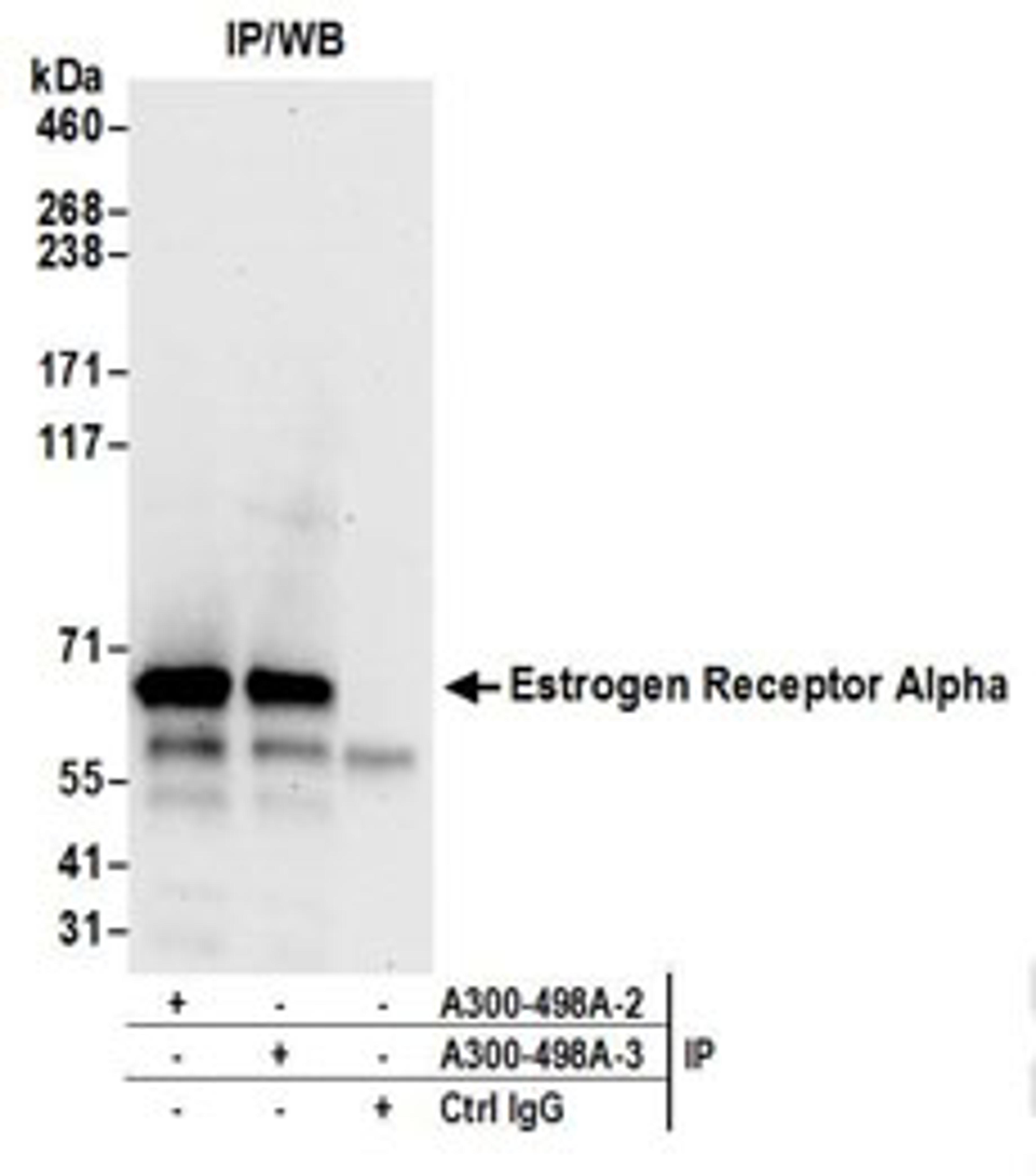 Detection of human Estrogen Receptor Alpha by western blot of immunoprecipitates.