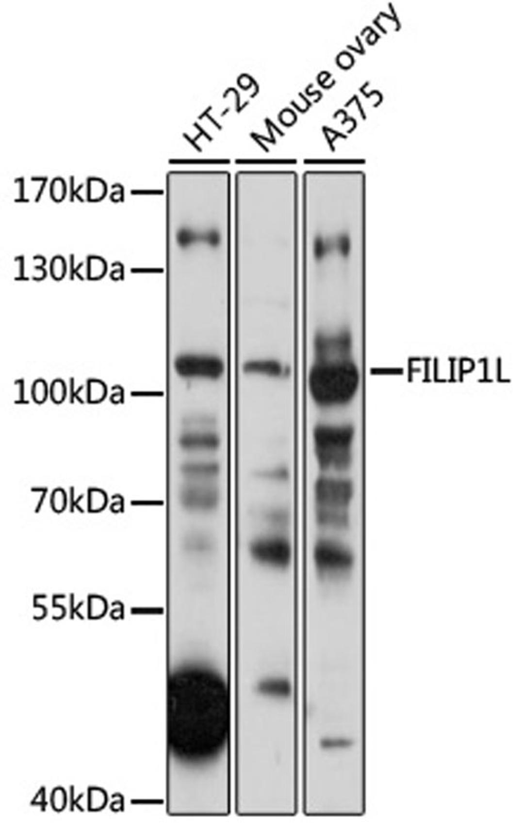 Western blot - FILIP1L antibody (A17861)