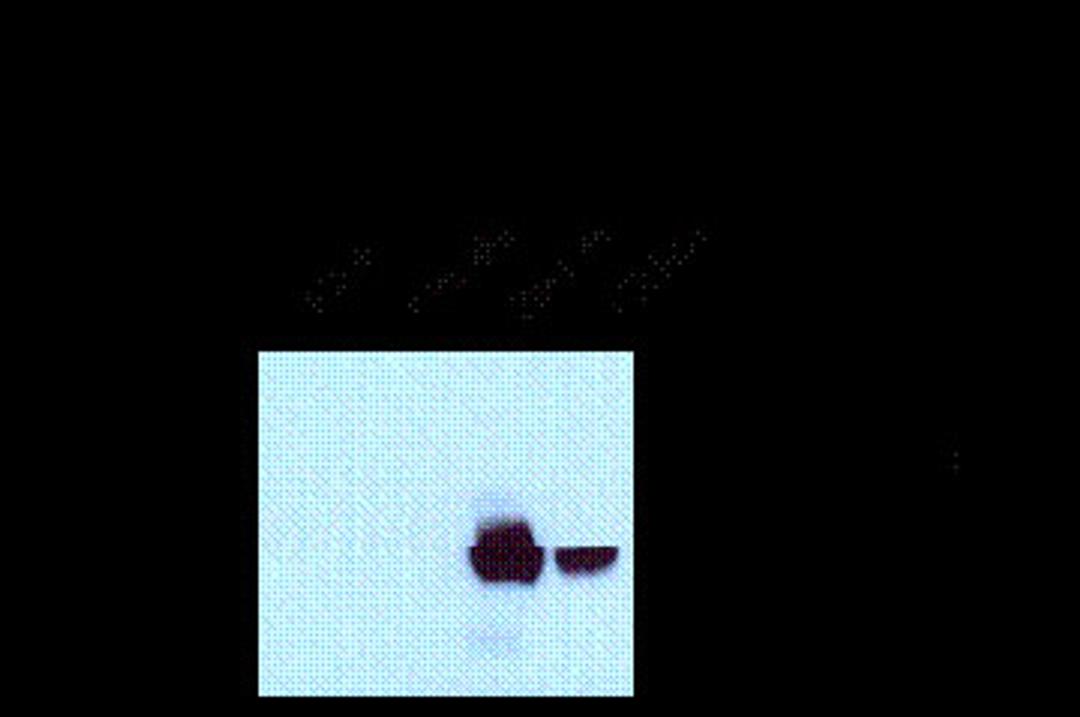 NMDA NR1, Splice Variant C2' Antibody