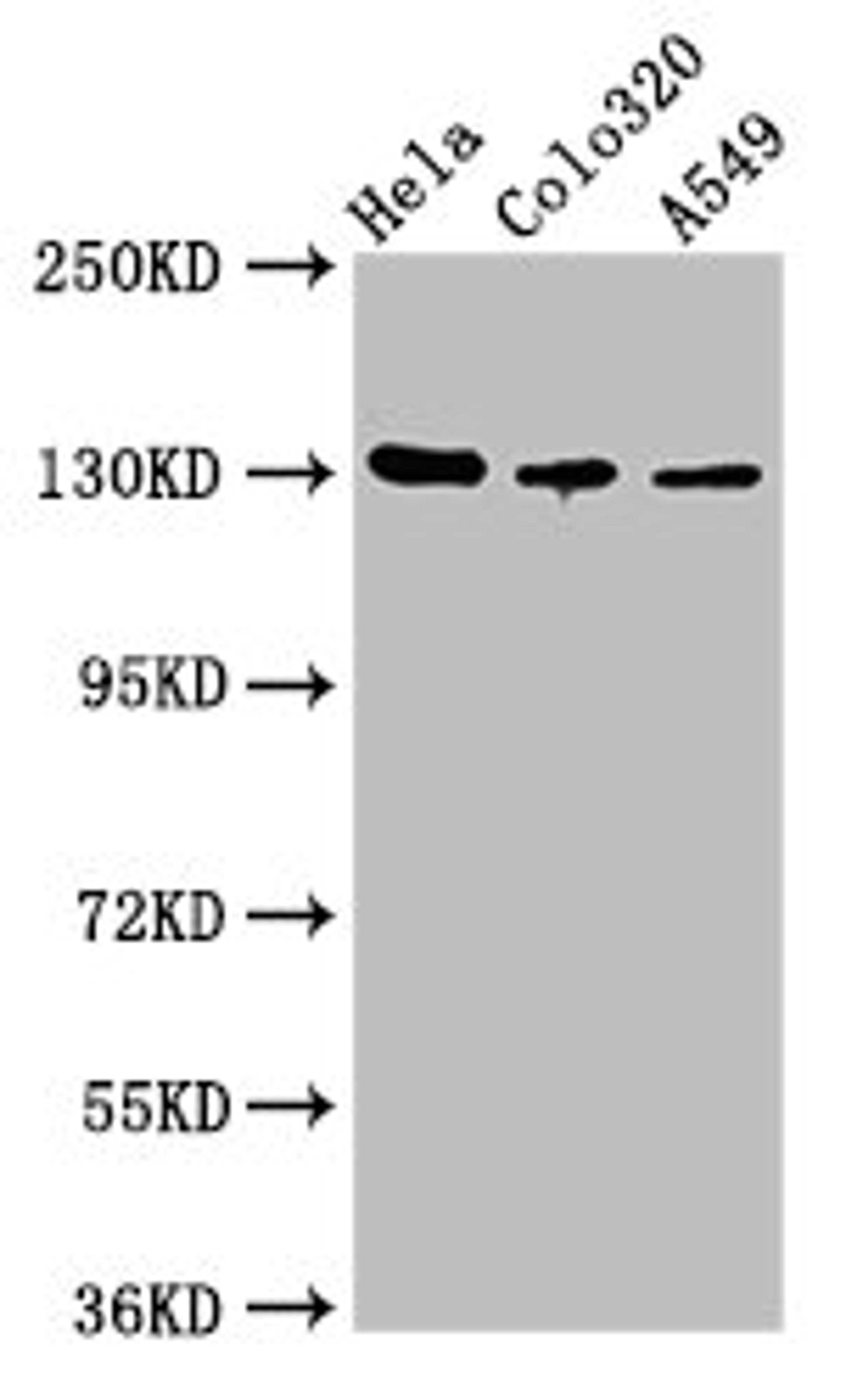 Western Blot. Positive WB detected in: Hela whole cell lysate, Colo320 whole cell lysate, A549 whole cell lysate. All lanes: ITGAV antibody at 2.7µg/ml. Secondary. Goat polyclonal to rabbit IgG at 1/50000 dilution. Predicted band size: 117, 113, 112 kDa. Observed band size: 130 kDa