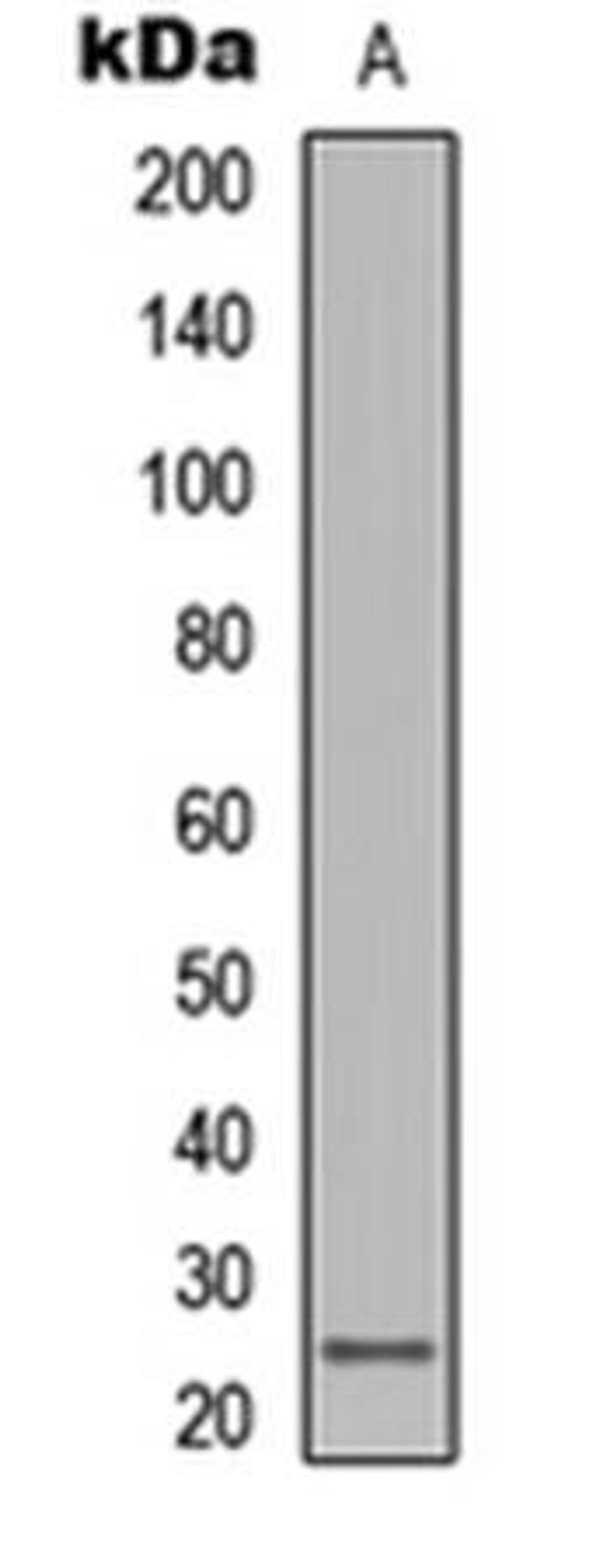 Western blot analysis of human lymph node (Lane1) whole cell using LT beta antibody