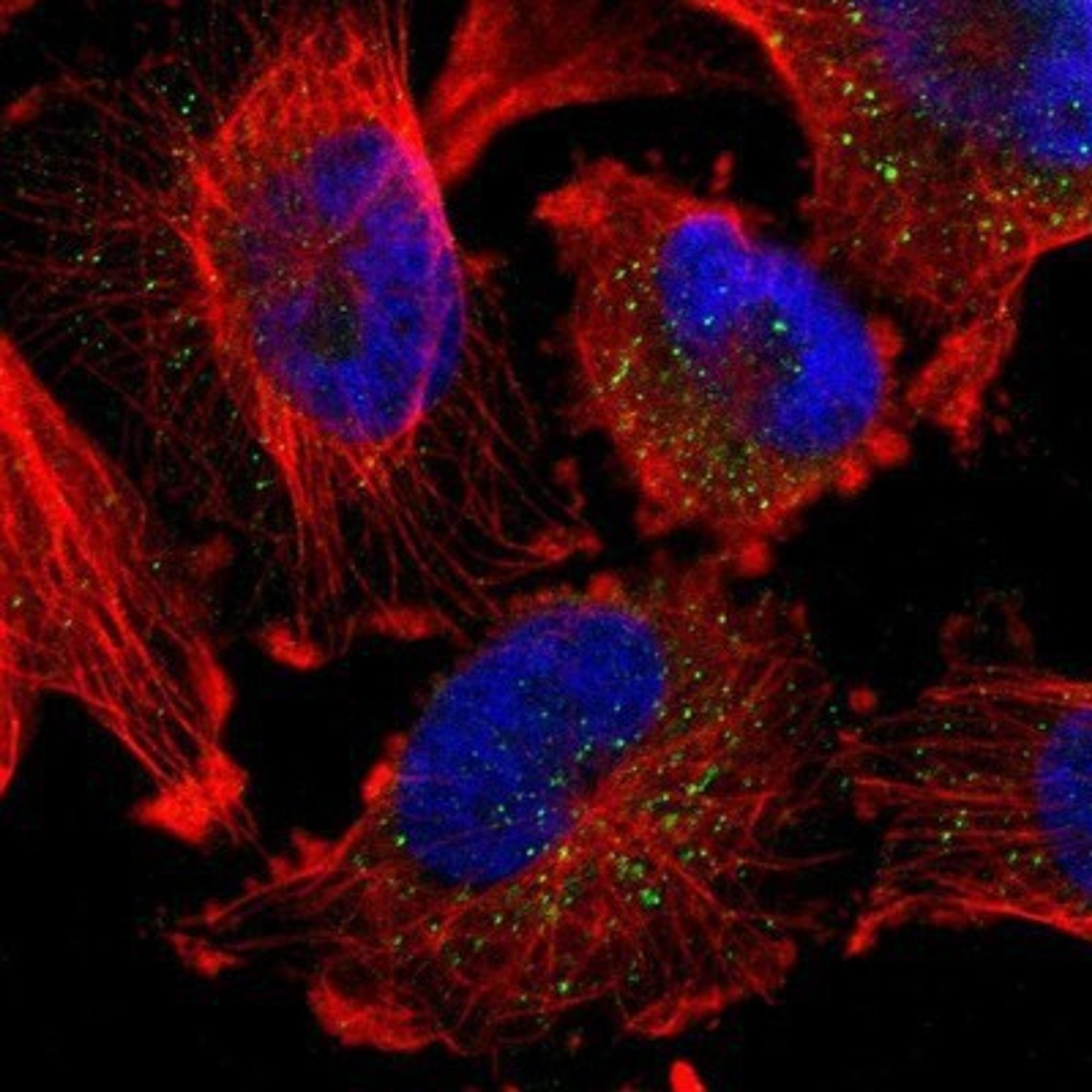 Immunocytochemistry/Immunofluorescence: GM2A Antibody [NBP1-87090] - Staining of human cell line U-251MG shows positivity in nucleoli & vesicles.