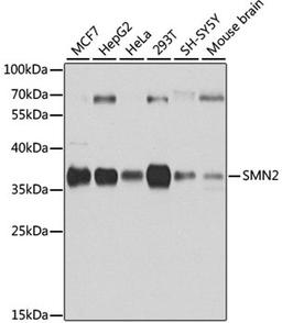 Western blot - SMN2 antibody (A12508)