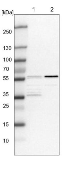 Western Blot: RAP1GDS1 Antibody [NBP1-87027] - Lane 1: NIH-3T3 cell lysate (Mouse embryonic fibroblast cells)<br/>Lane 2: NBT-II cell lysate (Rat Wistar bladder tumour cells)