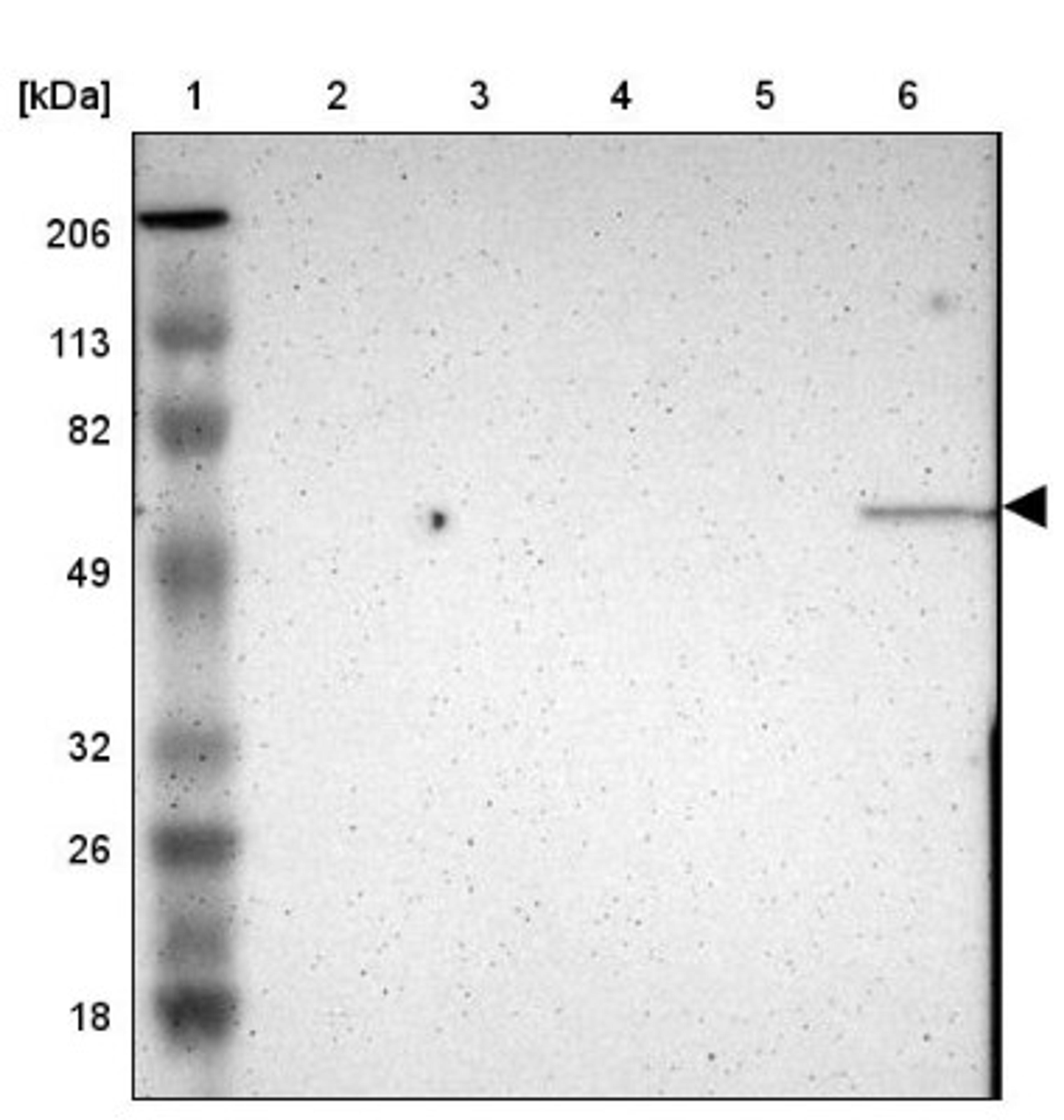 Western Blot: E74 like factor 1 Antibody [NBP1-90352] - Lane 1: Marker [kDa] 206, 113, 82, 49, 32, 26, 18<br/>Lane 2: Human cell line RT-4<br/>Lane 3: Human cell line U-251MG sp<br/>Lane 4: Human cell line A-431<br/>Lane 5: Human liver tissue<br/>Lane 6: Human tonsil tissue