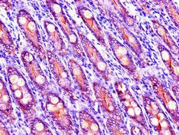 Immunohistochemistry of paraffin-embedded human small intestine tissue using CSB-PA897572LA01HU at dilution of 1:100