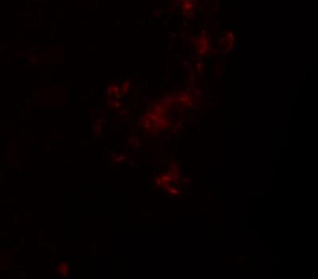 Immunocytochemistry/Immunofluorescence: ZBTB5 Antibody [NBP1-76518] - Immunofluorescence of ZBTB5 in human brain tissue with ZBTB5 antibody at 20 ug/mL.