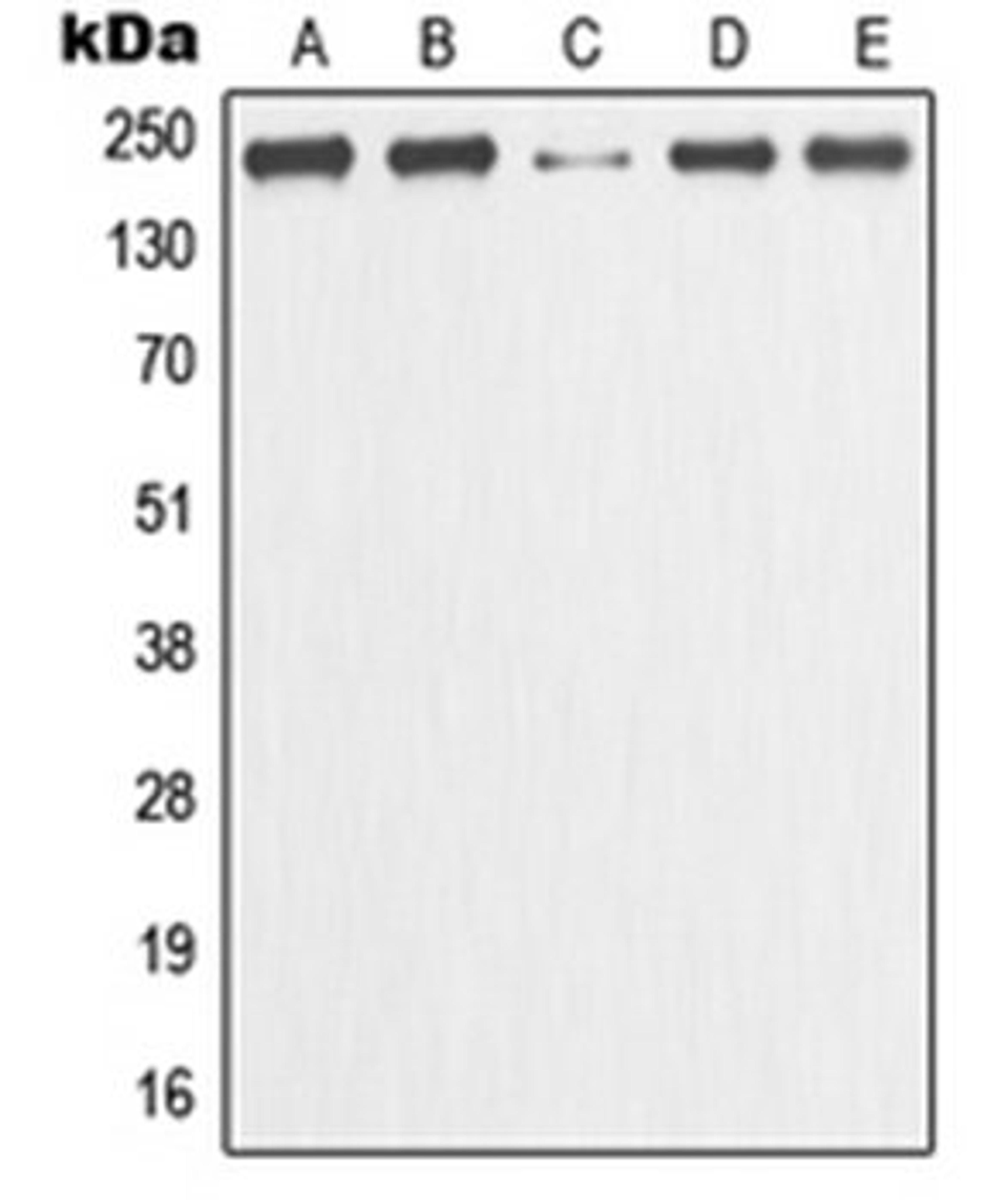 Western blot analysis of HeLa (Lane 1), MCF7 (Lane 2), Raw264.7 (Lane 3), mouse liver (Lane 4), rat kidney (Lane 5) whole cell lysates using MCM3AP antibody