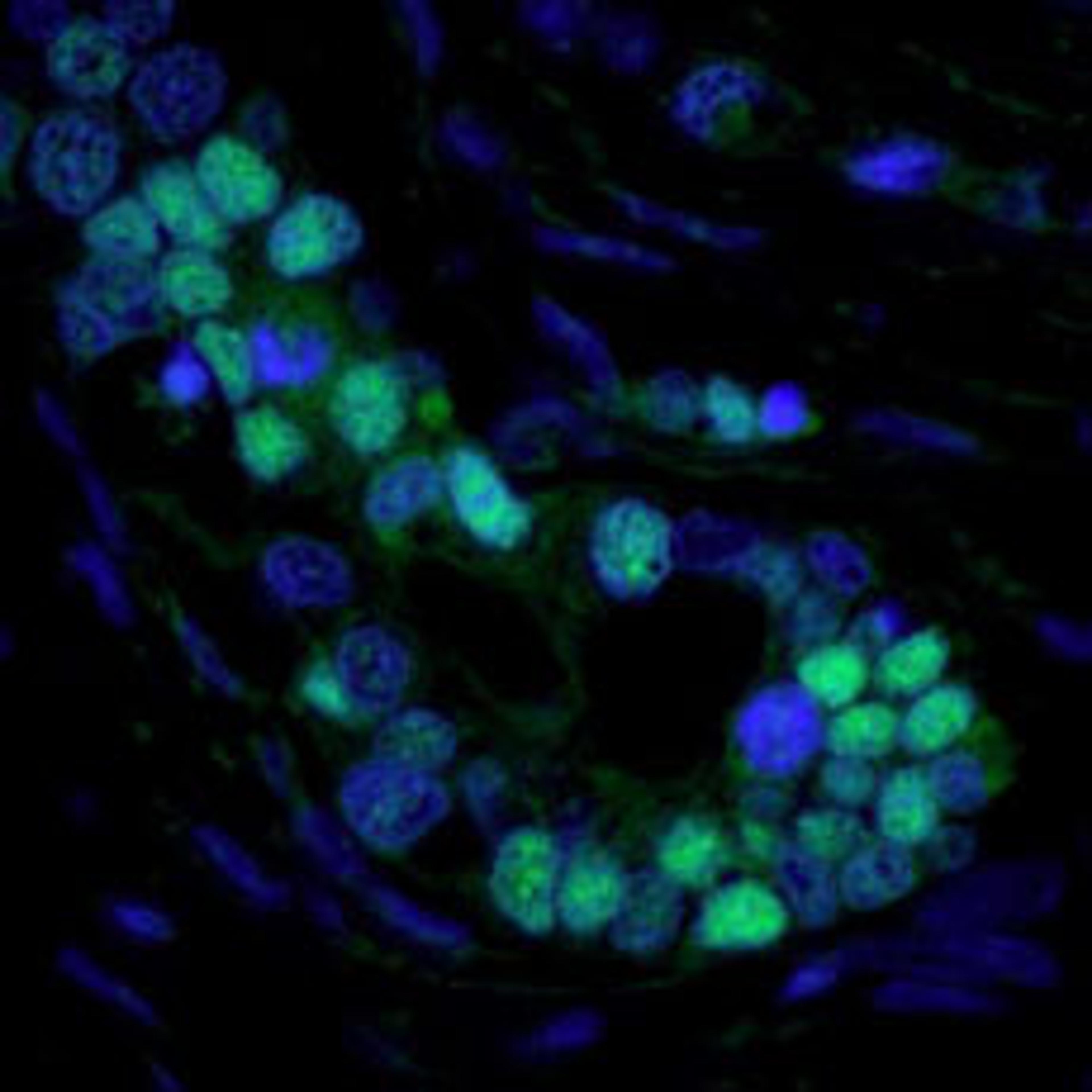 Detection of human p53 by immunofluorescence.