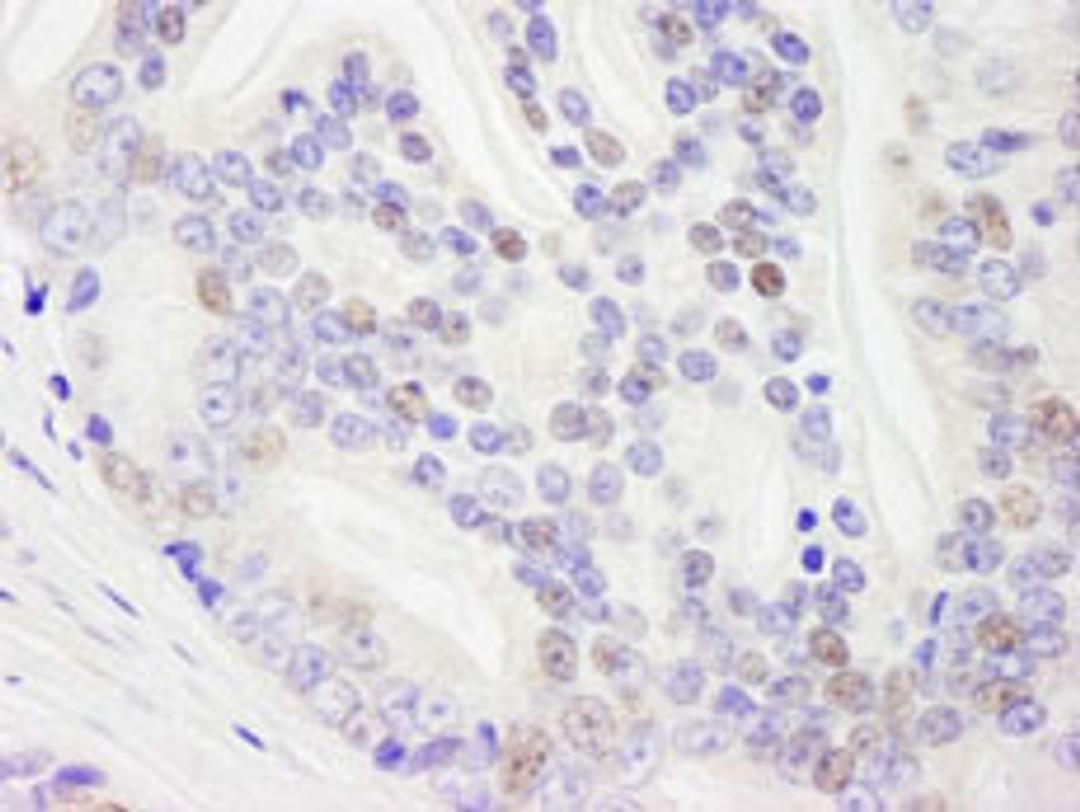 Detection of human DHX9 by immunohistochemistry.