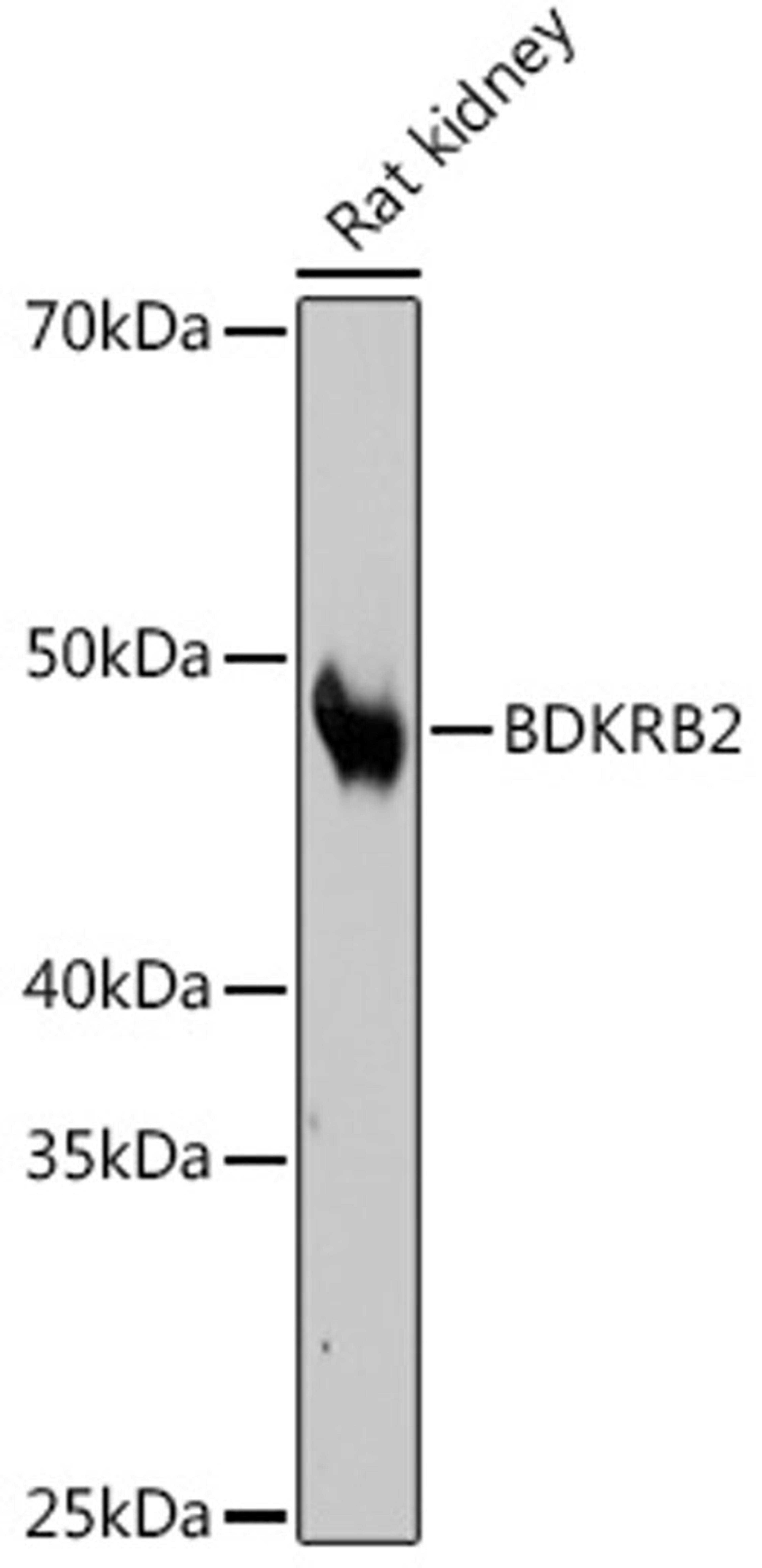 Western blot - BDKRB2 Rabbit mAb (A4756)