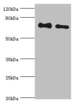Western blot. All lanes: Cytoplasmic tyrosine-protein kinase BMX antibody at 4ug/ml. Lane 1: A549 whole cell lysate. Lane 2: Mouse heart tissue. Secondary. Goat polyclonal to rabbit IgG at 1/10000 dilution. Predicted band size: 78 kDa. Observed band size: 78 kDa. 