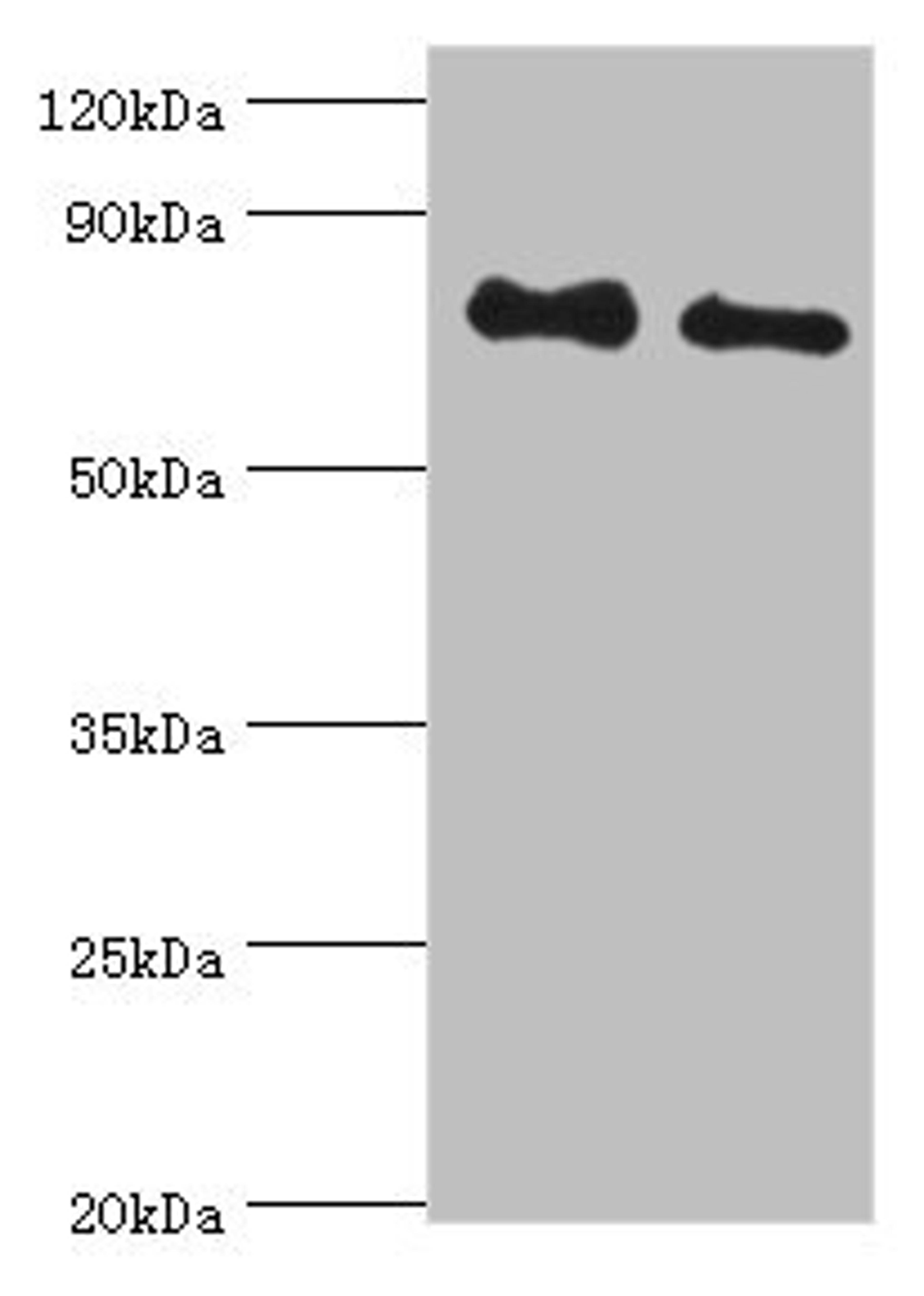 Western blot. All lanes: Cytoplasmic tyrosine-protein kinase BMX antibody at 4ug/ml. Lane 1: A549 whole cell lysate. Lane 2: Mouse heart tissue. Secondary. Goat polyclonal to rabbit IgG at 1/10000 dilution. Predicted band size: 78 kDa. Observed band size: 78 kDa. 