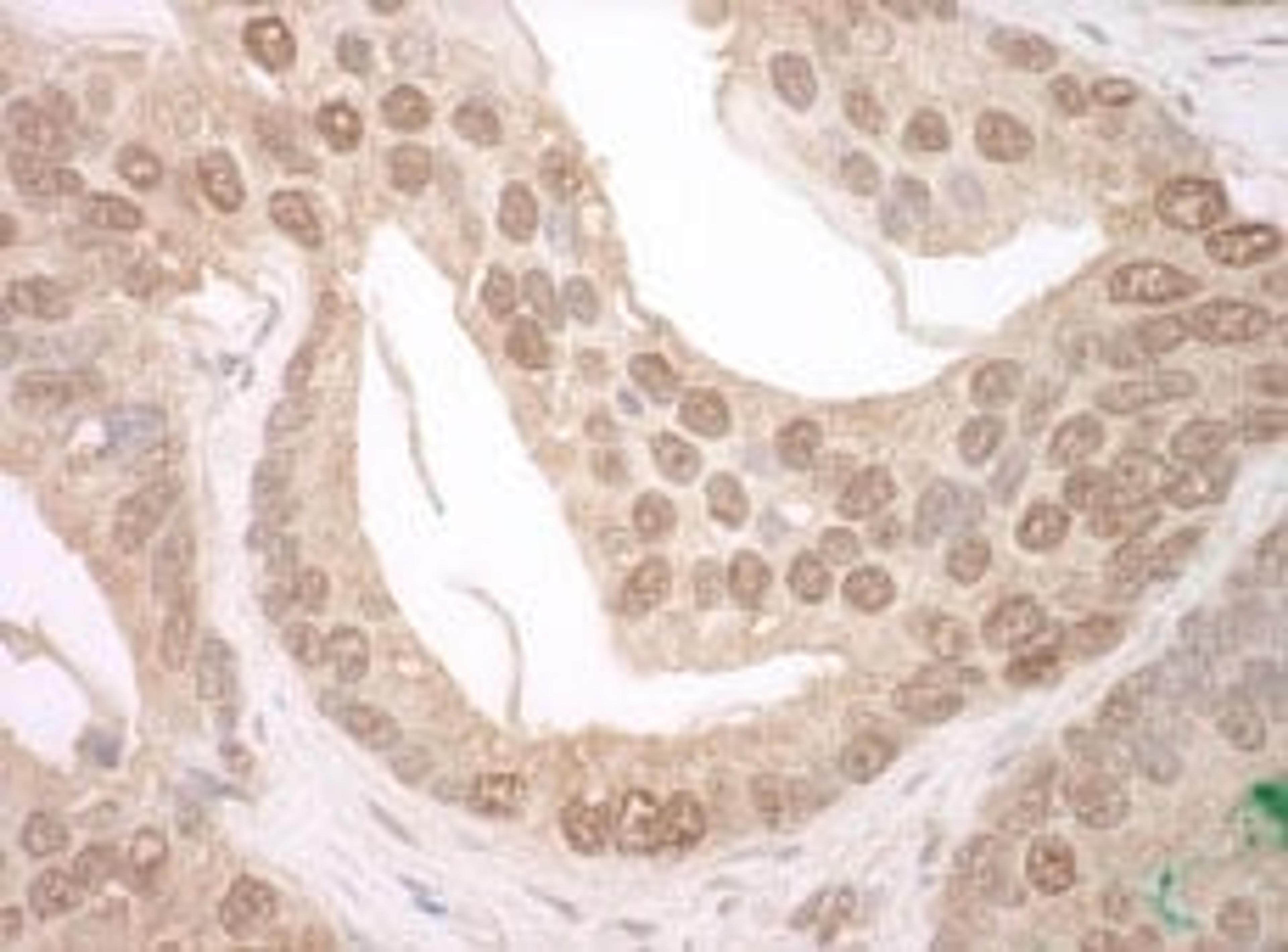 Detection of human TFIP11 by immunohistochemistry.