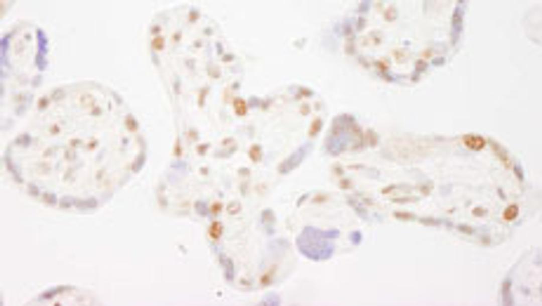 Detection of human COBRA1 by immunohistochemistry.