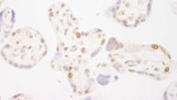 Detection of human COBRA1 by immunohistochemistry.