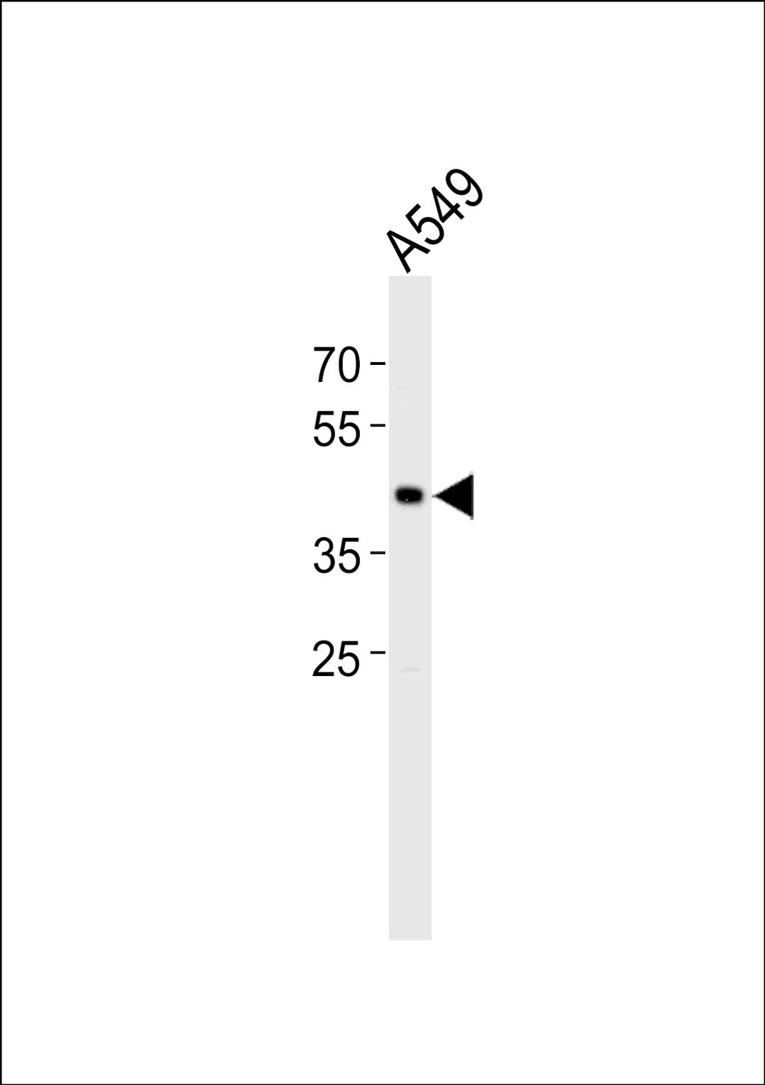 Western blot analysis of lysate from A549 cell line, using TGIF1 Antibody at 1:1000.