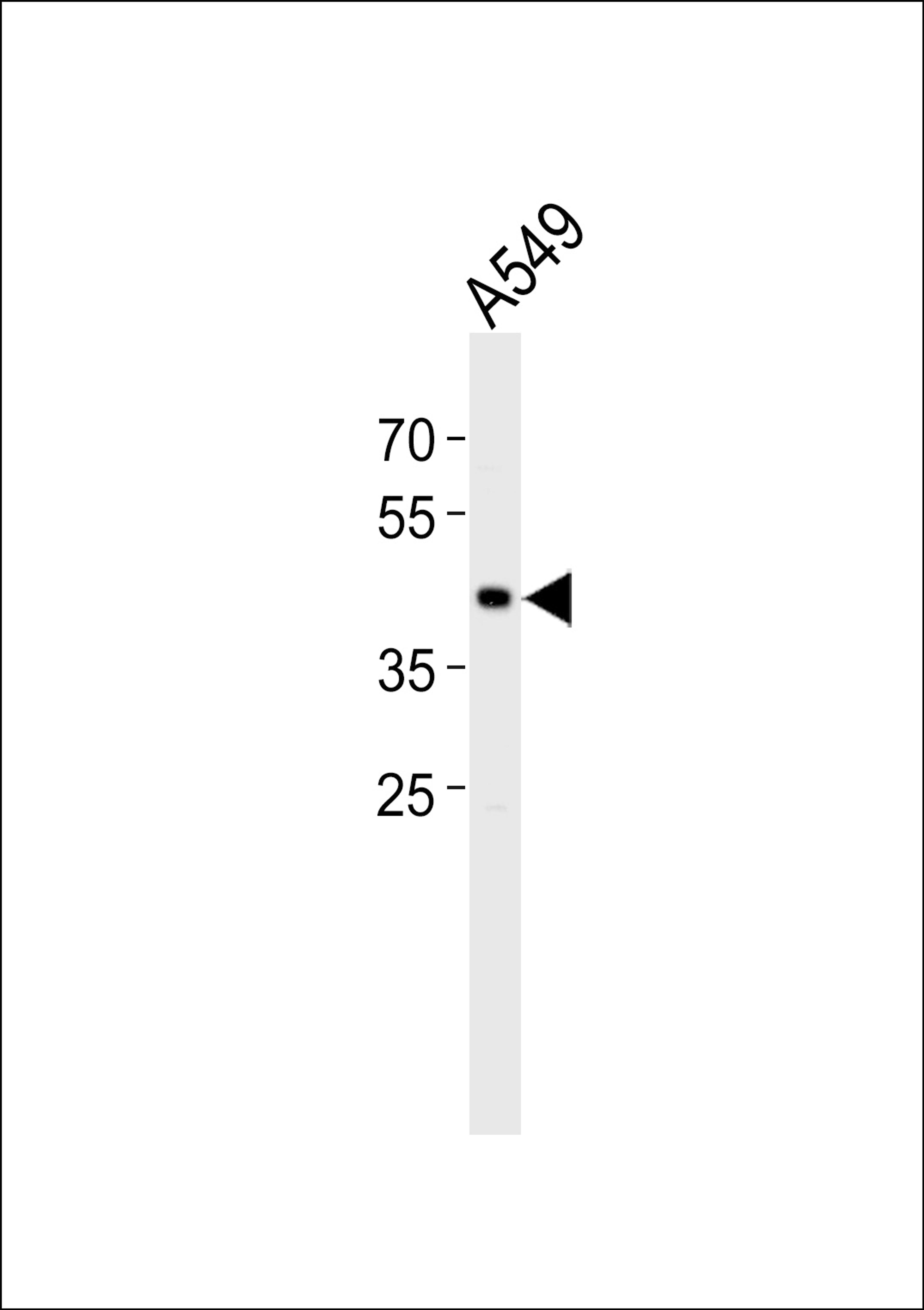 Western blot analysis of lysate from A549 cell line, using TGIF1 Antibody at 1:1000.