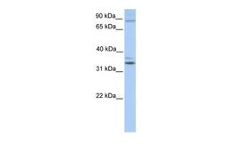 Antibody used in WB on Human Heart at 0.2-1 ug/ml.