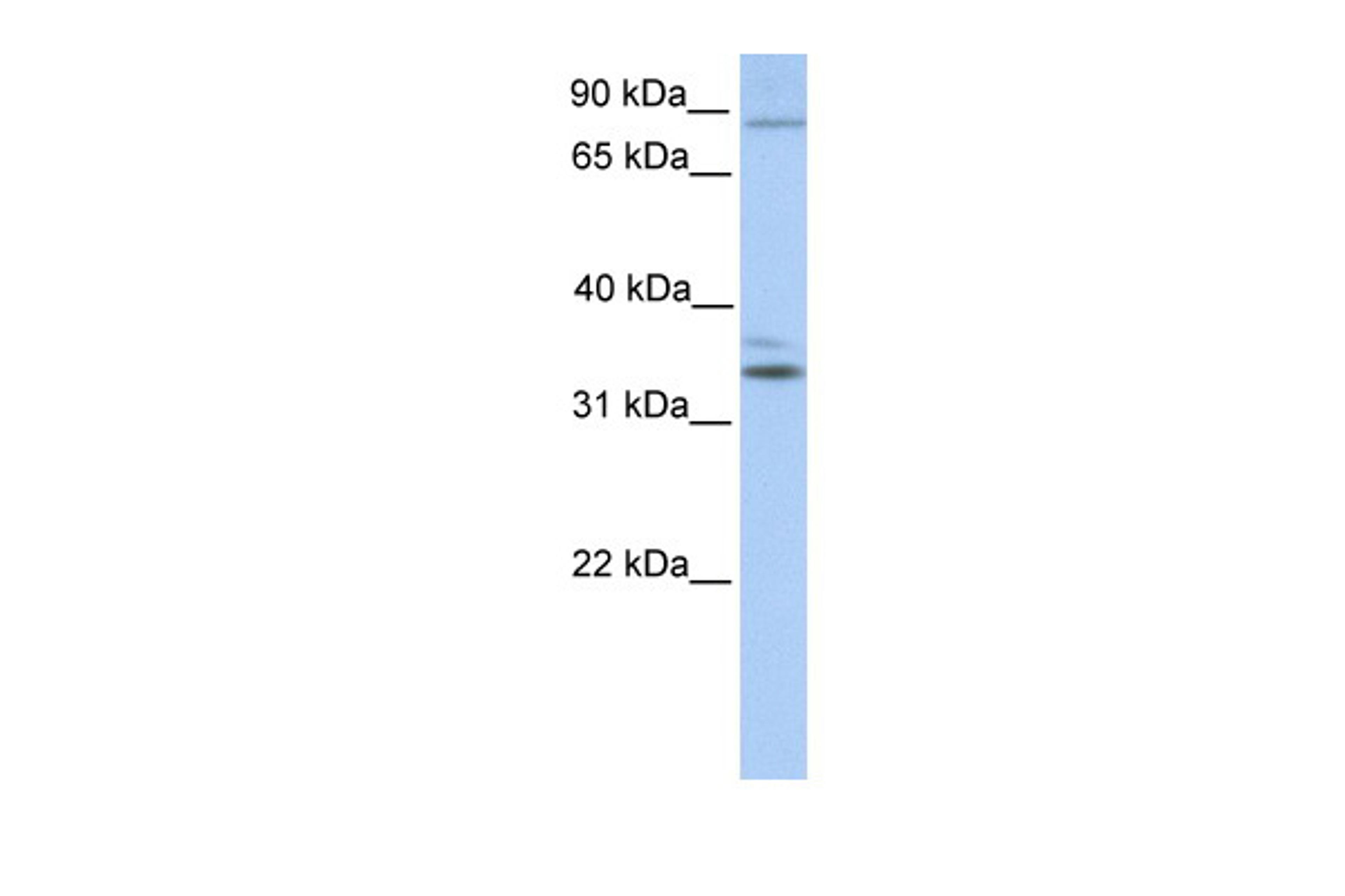 Antibody used in WB on Human Heart at 0.2-1 ug/ml.