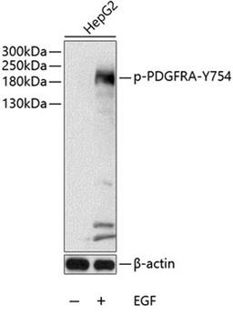 Western blot - Phospho-PDGFRA-Y754 antibody (AP0568)