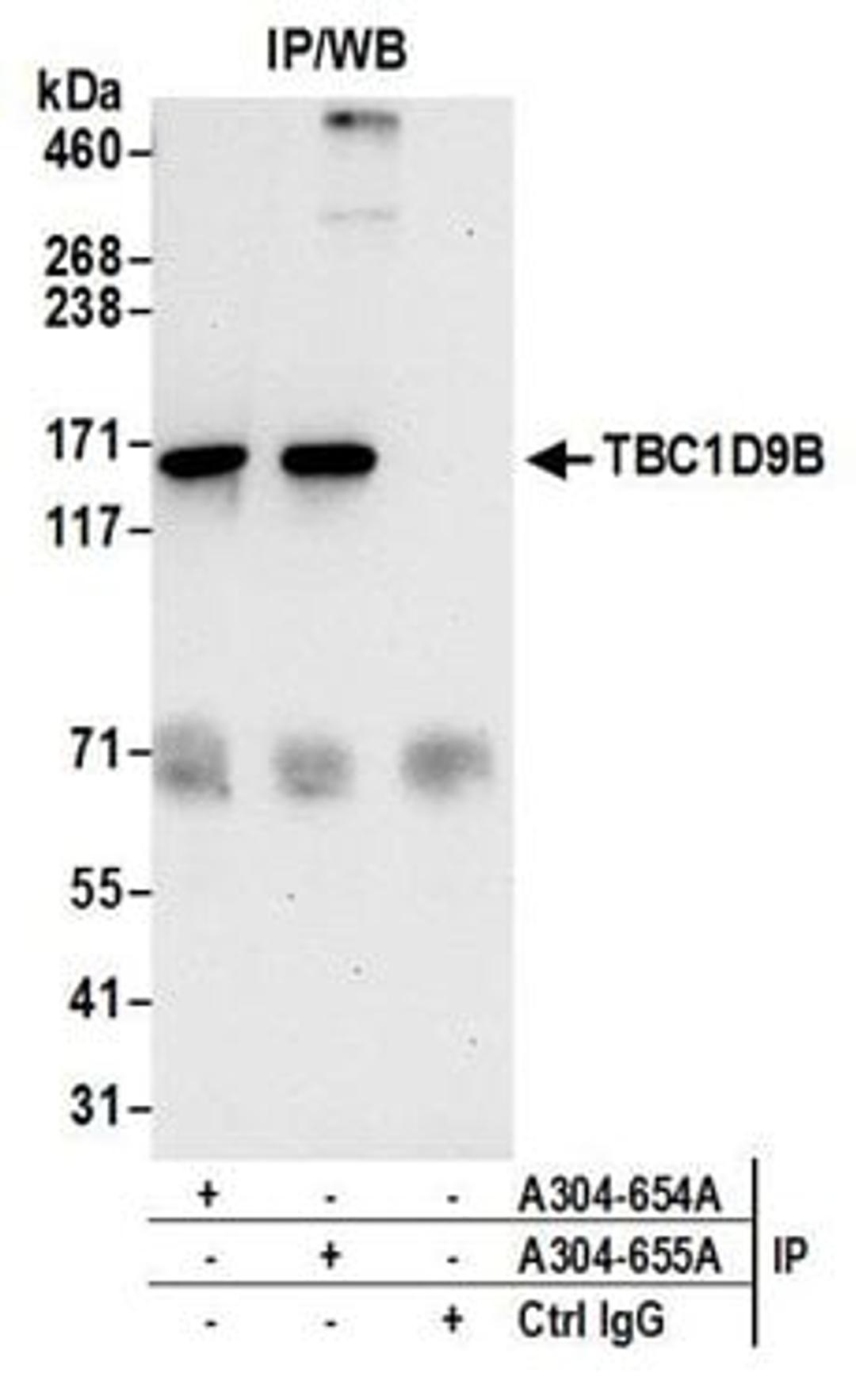 Detection of human TBC1D9B by western blot of immunoprecipitates.