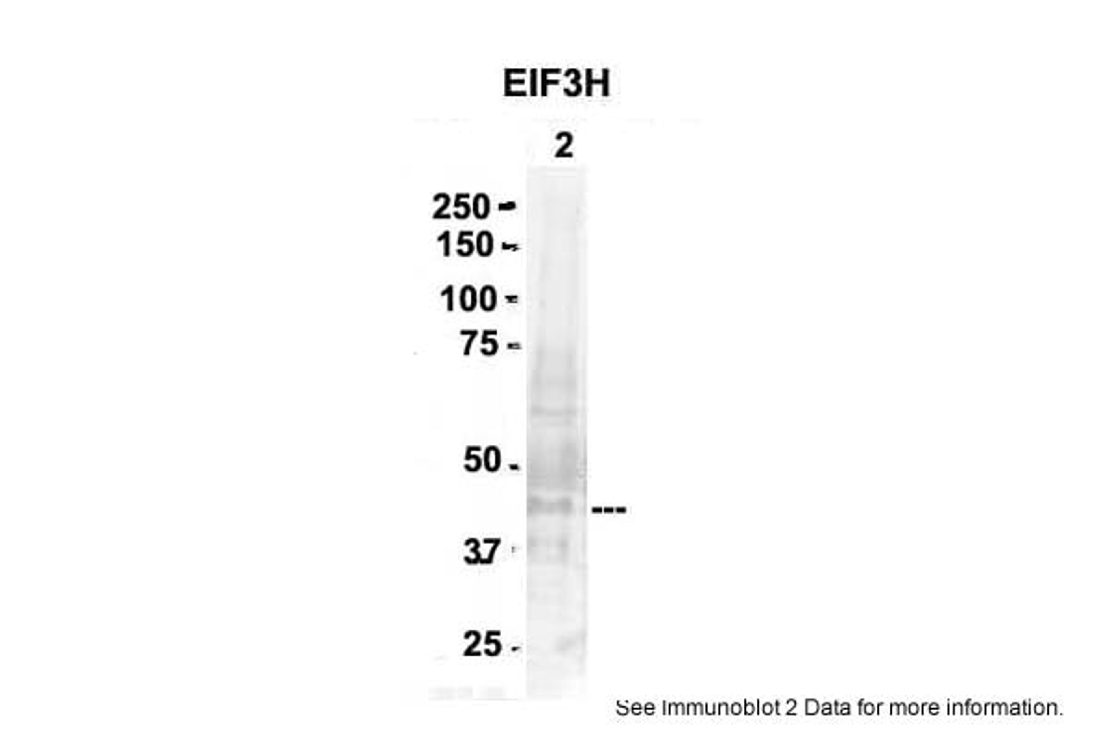 Antibody used in WB on Mouse Brain at 2 ug/ml.