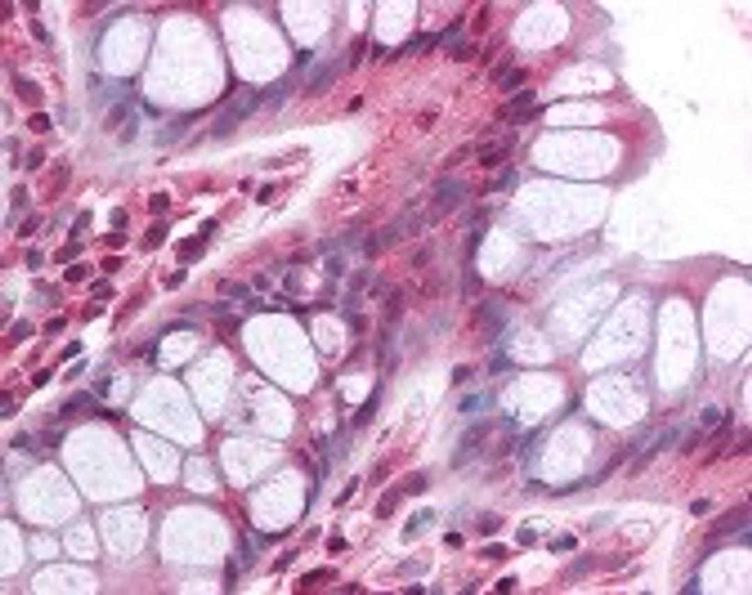 Immunohistochemistry staining of PDGFRL in colon tissue using PDGFRL Antibody.