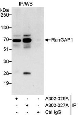 Detection of human RanGAP1 by western blot of immunoprecipitates.