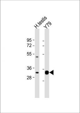 Western Blot at 1:1000 dilution Lane 1: human testis lysate Lane 2: Y79 whole cell lysate Lysates/proteins at 20 ug per lane.