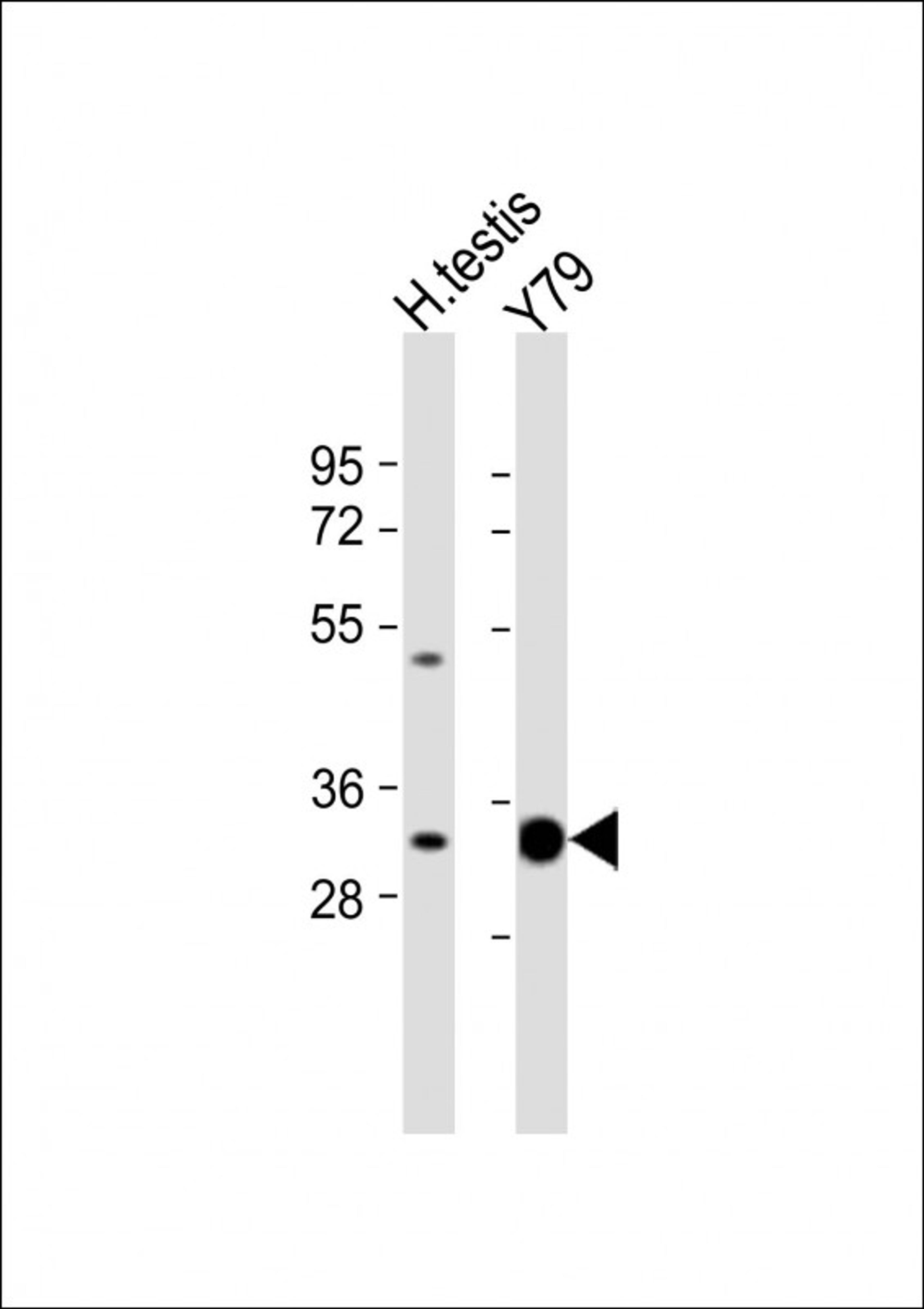 Western Blot at 1:1000 dilution Lane 1: human testis lysate Lane 2: Y79 whole cell lysate Lysates/proteins at 20 ug per lane.