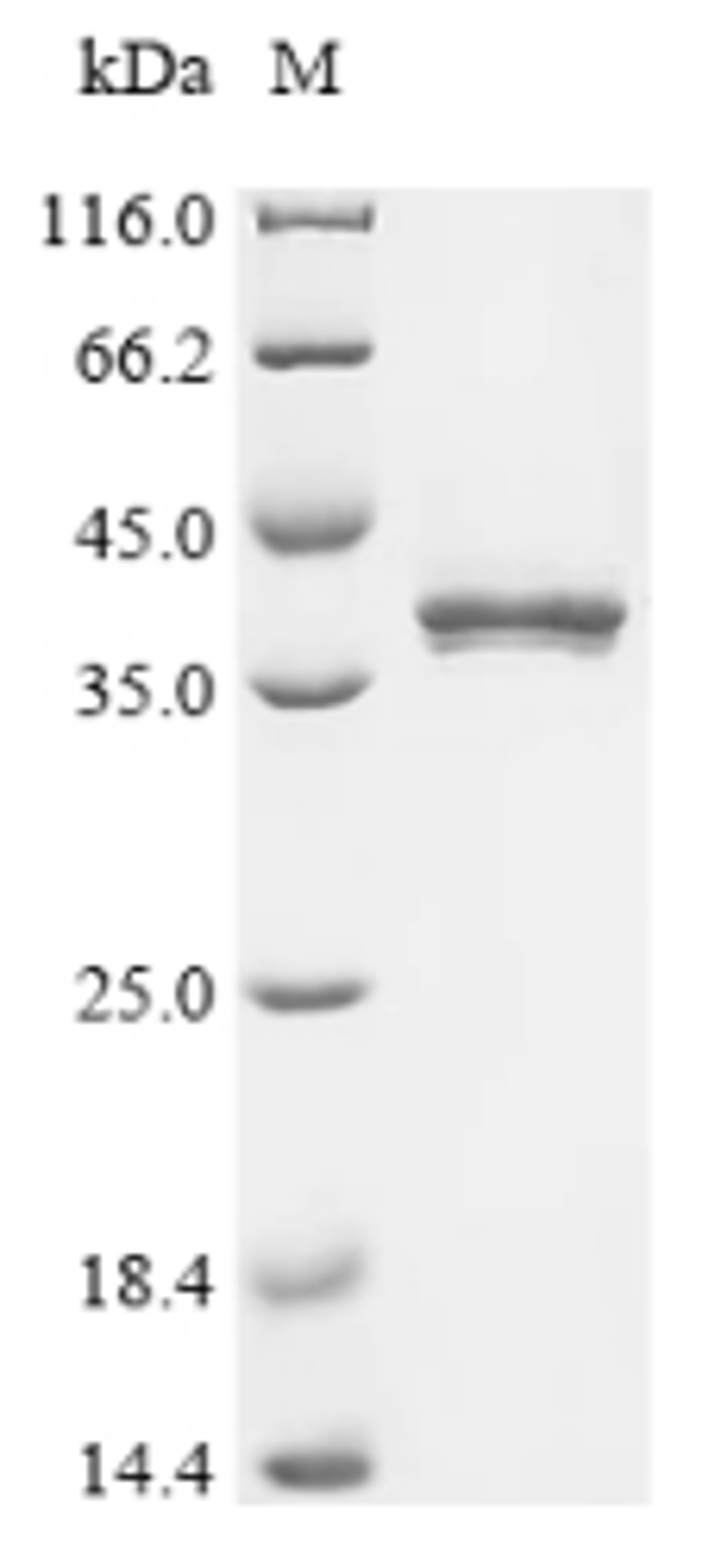 (Tris-Glycine gel) Discontinuous SDS-PAGE (reduced) with 5% enrichment gel and 15% separation gel.