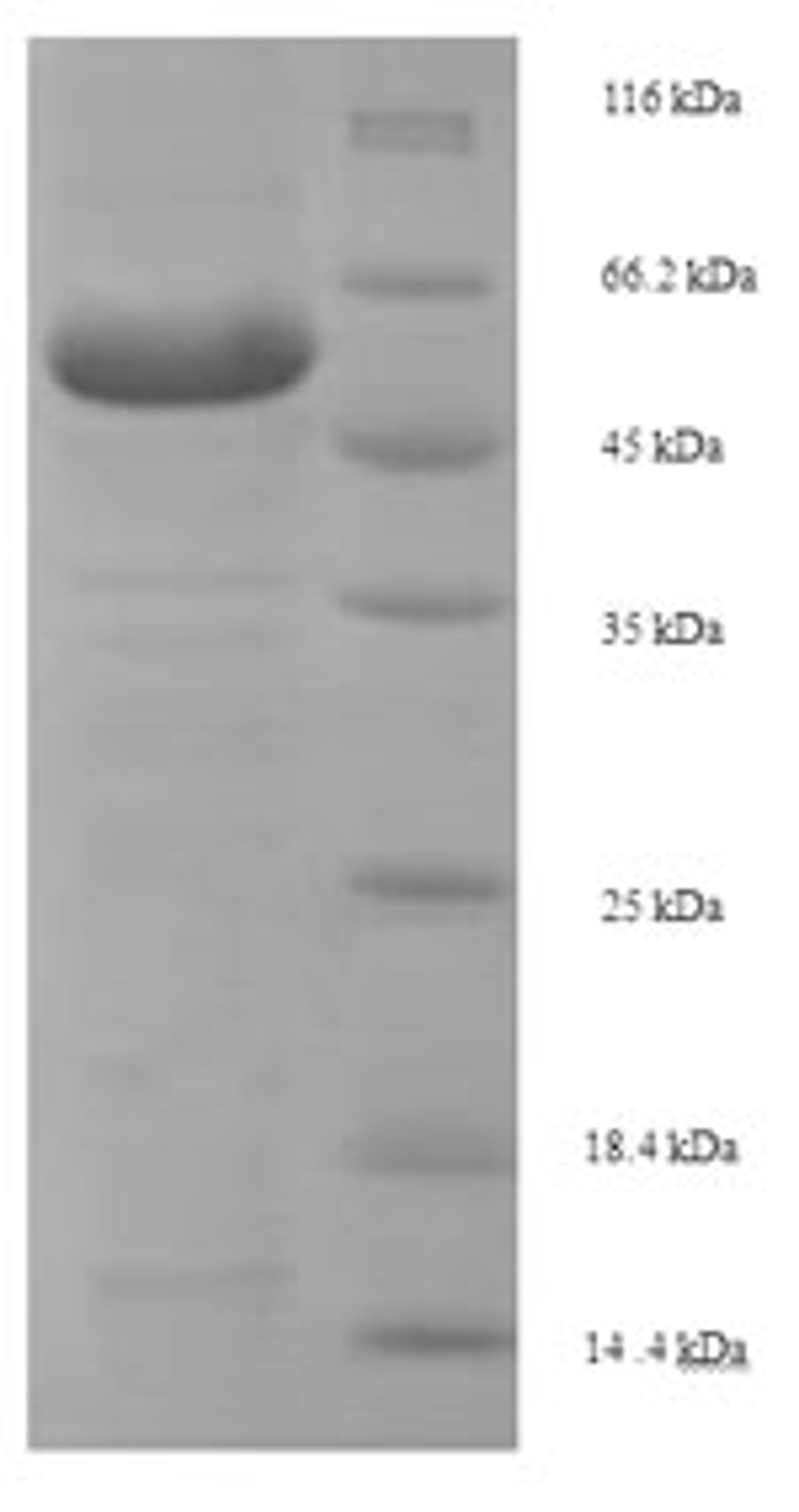 (Tris-Glycine gel) Discontinuous SDS-PAGE (reduced) with 5% enrichment gel and 15% separation gel.