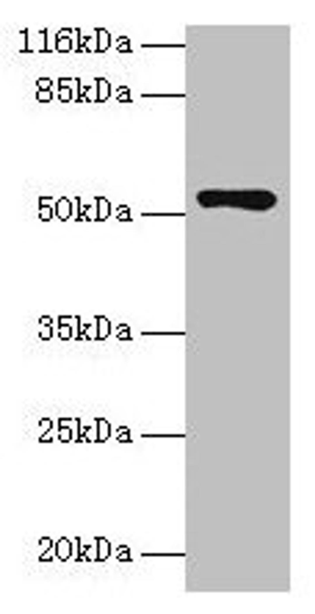 Western blot. All lanes: CCDC14 antibody at 2µg/ml + Jurkat whole cell lysate. Secondary. Goat polyclonal to rabbit IgG at 1/10000 dilution. Predicted band size: 107, 84, 89, 52, 102 kDa. Observed band size: 52 kDa