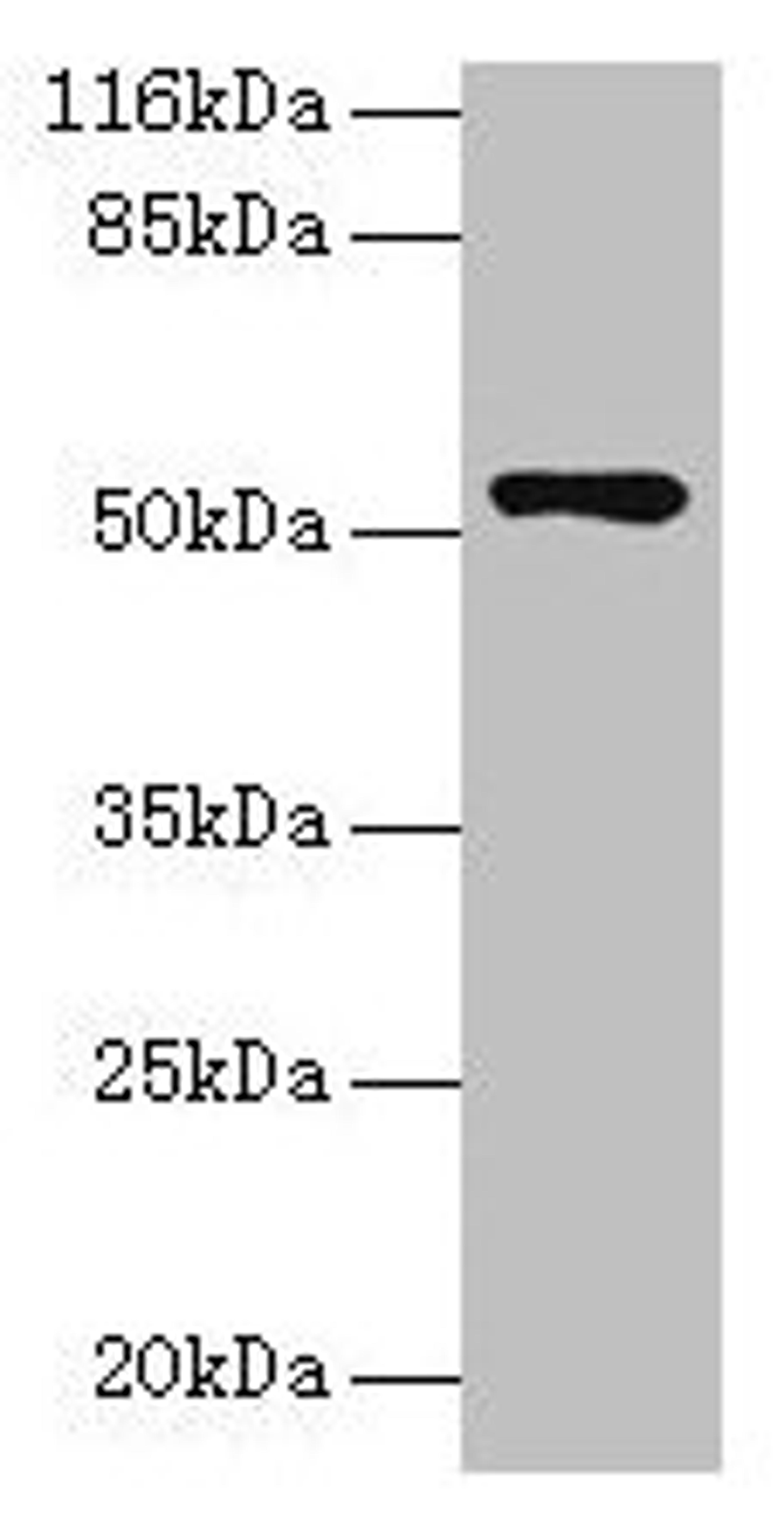 Western blot. All lanes: CCDC14 antibody at 2µg/ml + Jurkat whole cell lysate. Secondary. Goat polyclonal to rabbit IgG at 1/10000 dilution. Predicted band size: 107, 84, 89, 52, 102 kDa. Observed band size: 52 kDa