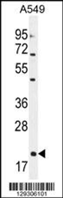 Western blot analysis in A549 cell line lysates (35ug/lane).