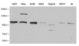 Western Blot. Positive WB detected in: U251 whole cell lysate, Hela whole cell lysate, A549 whole cell lysate, K562 whole cell lysate, HepG2 whole cell lysate, MCF-7 whole cell lysate, Jurkat whole cell lysate. All lanes: MBTPS1 antibody at 1:1000. Secondary. Goat polyclonal to mouse IgG at 1/50000 dilution. Predicted band size: 117 kDa. Observed band size: 117 KDa. Exposure time:5min