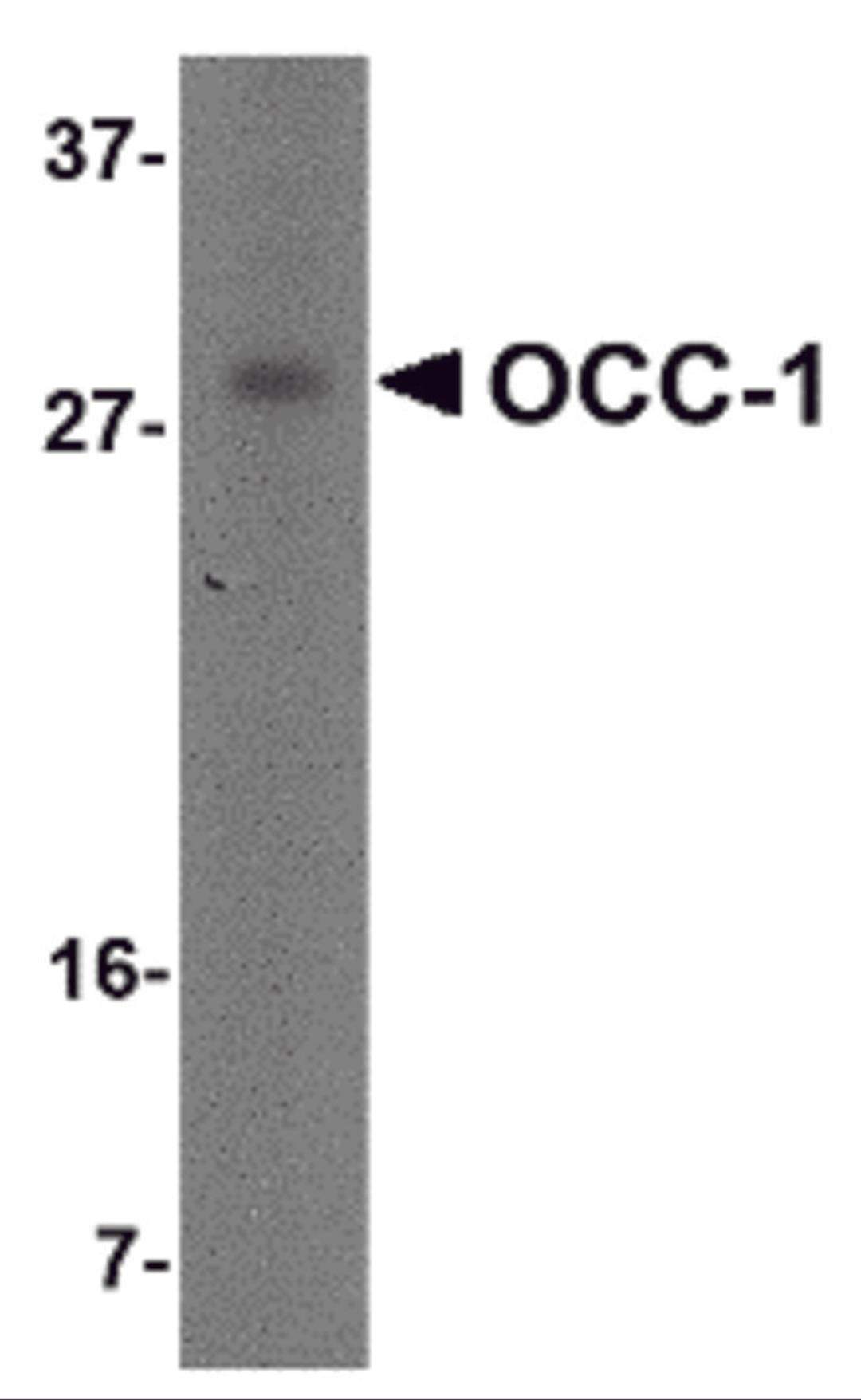 Western blot analysis of OCC-1 in human spleen tissue lysate with OCC-1 antibody at 2 &#956;g/mL.