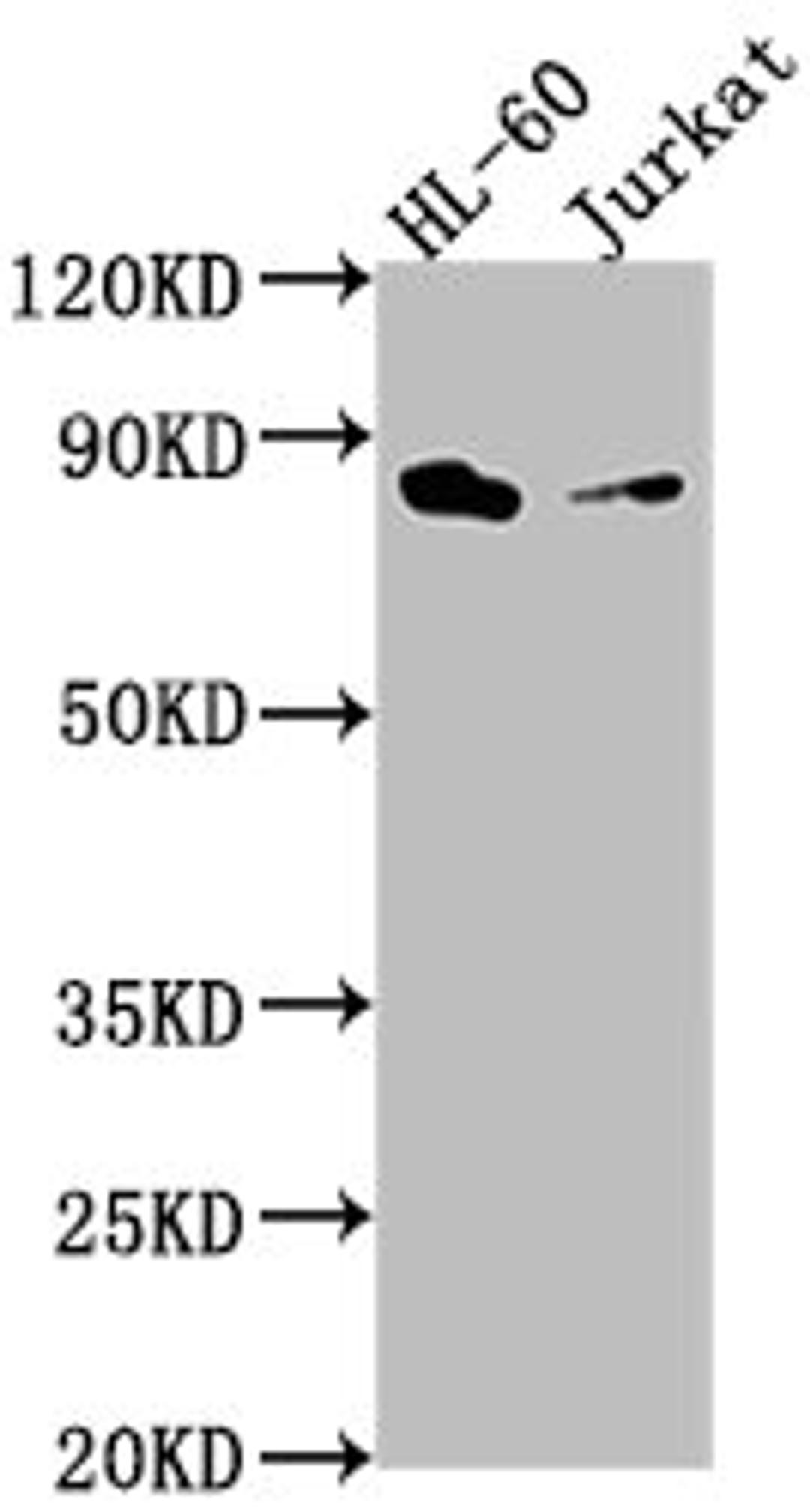 Western Blot. Positive WB detected in: HL-60 whole cell lysate, Jurkat whole cell lysate. All lanes: ELMO1 antibody at 1:2000. Secondary. Goat polyclonal to rabbit IgG at 1/50000 dilution. Predicted band size: 84, 29, 50 kDa. Observed band size: 84 kDa.