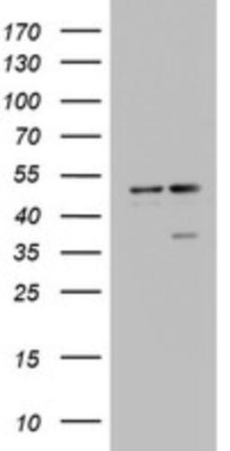 Western Blot: DAP3 Antibody (1B12) [NBP2-46427] - Analysis of HEK293T cells were transfected with the pCMV6-ENTRY control (Left lane) or pCMV6-ENTRY DAP3.