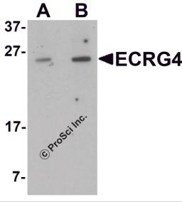 Western blot analysis of ECRG4 in HeLa cell lysate with ECRG4 antibody at (A) 1 and (B) 2 μg/mL.