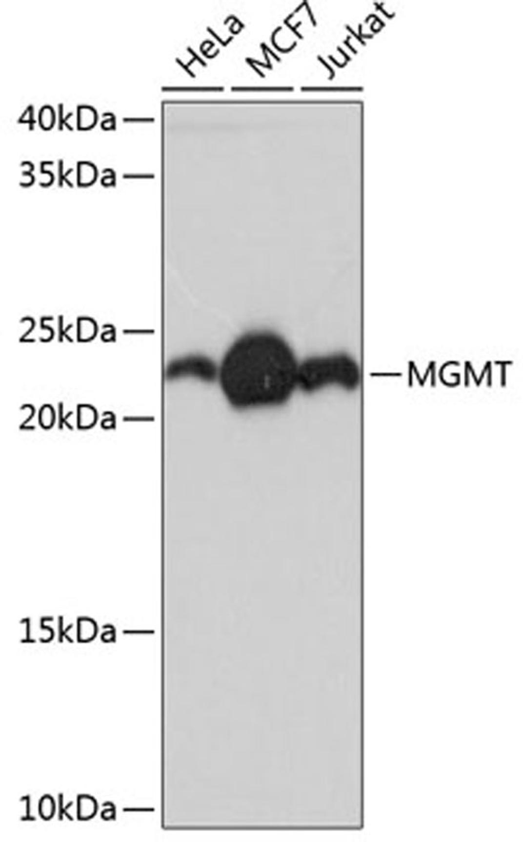 Western blot - MGMT Rabbit mAb (A11151)