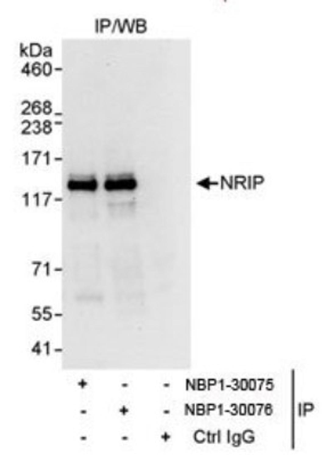 Immunoprecipitation: NRIP Antibody [NBP1-30075] - Whole cell lysate from HeLa cells. NBP1-30075 used for IP at 10 mcg/mg lysate. NRIP was also immunoprecipitated by NBP1-30076. For blotting immunoprecipitated NRIP, NBP1-30076  was used at 1 mcg/ml.