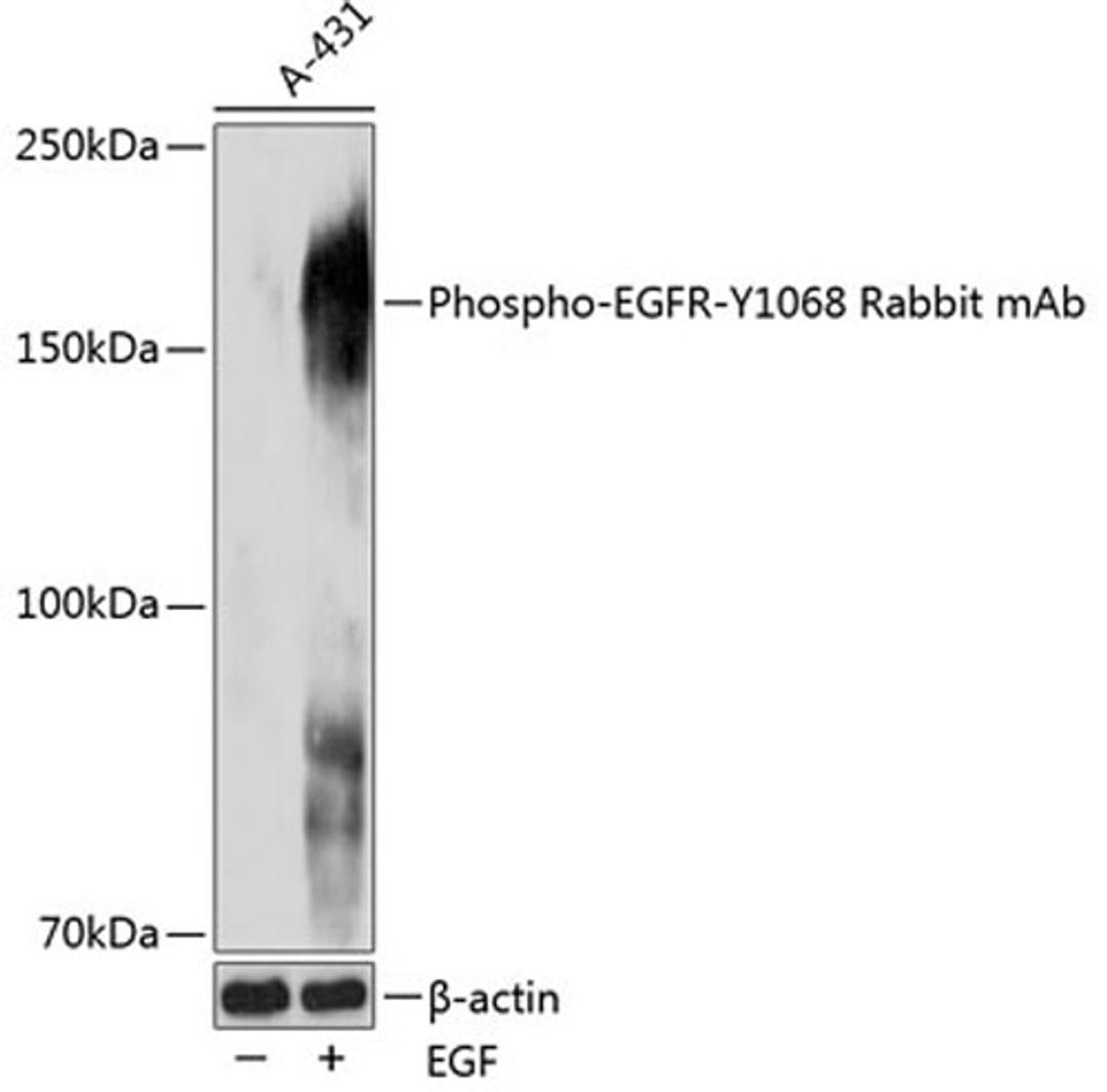 Western blot - Phospho-EGFR-Y1068 Rabbit mAb (AP0027)