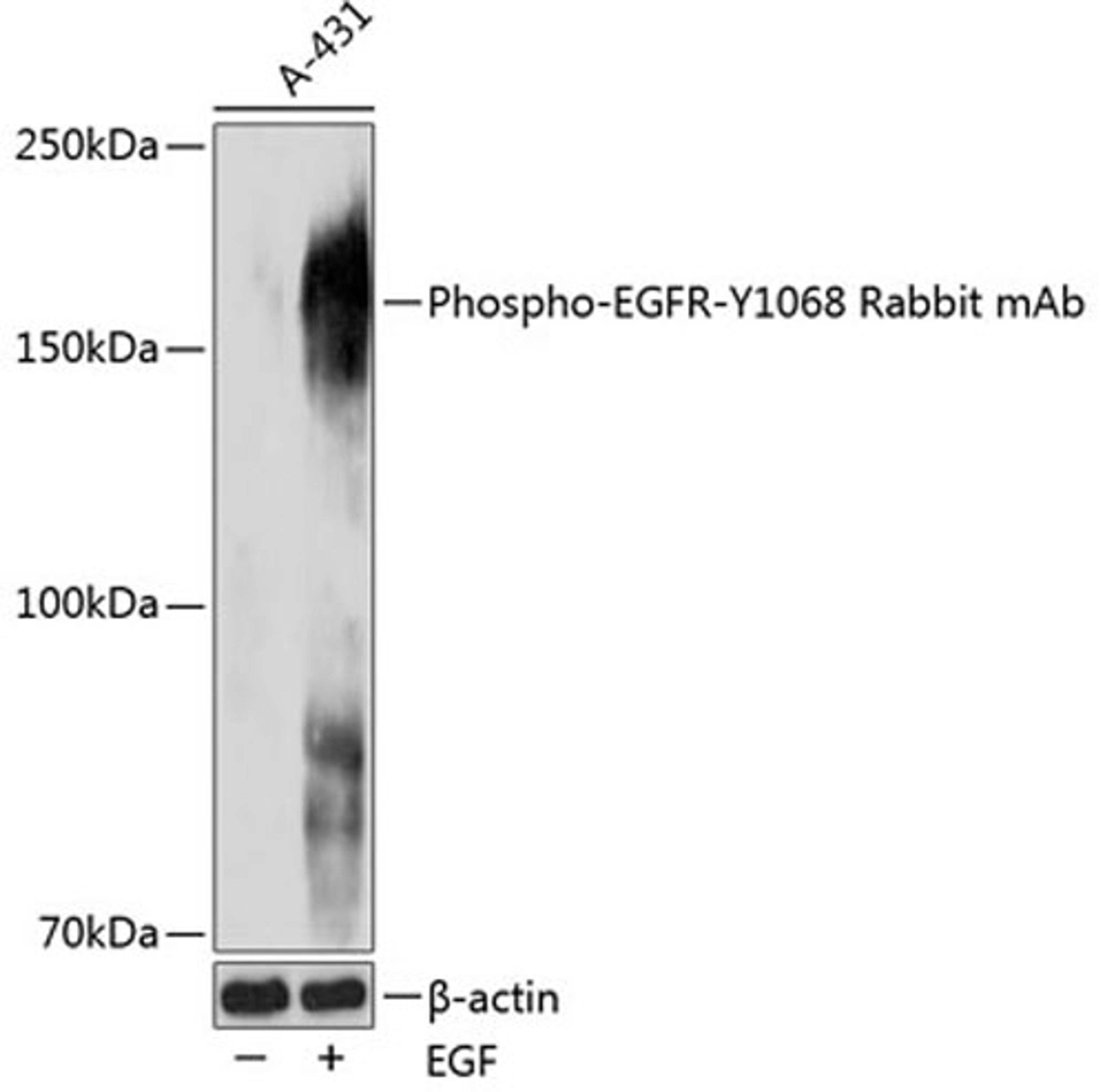 Western blot - Phospho-EGFR-Y1068 Rabbit mAb (AP0027)