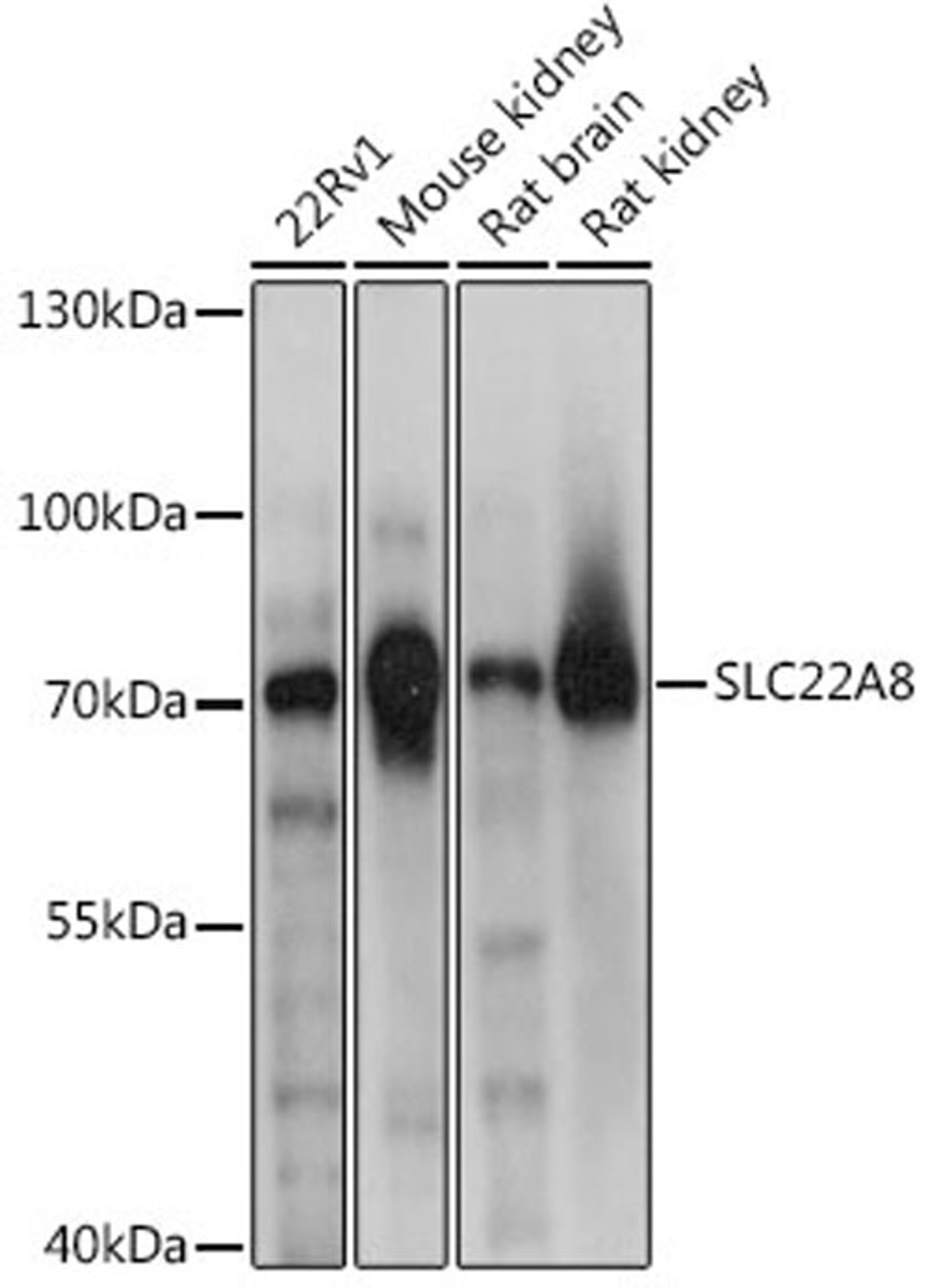 Western blot - SLC22A8 antibody (A14575)