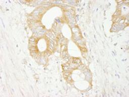 Detection of human eIF3J/EIF3S1 by immunohistochemistry.